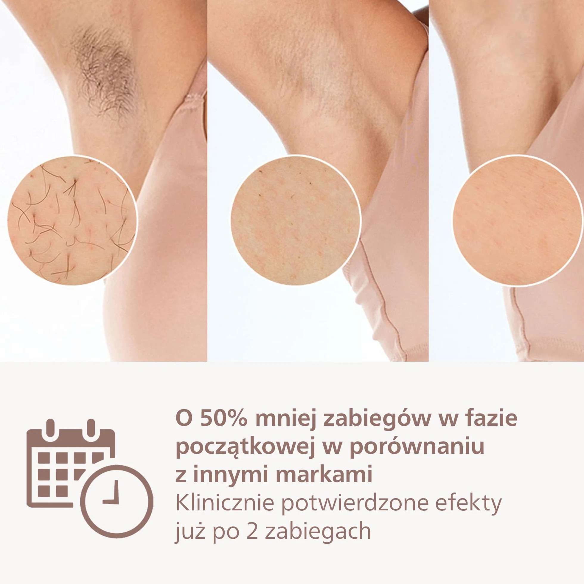 Philips Lumea z serii 7000 - urządzenie IPL do depilacji światłem. Zestaw z 2 nasadkami: do ciała i twarzy oraz ołówkowym trymerem do wyrównywania Satin Compact. Zasilanie sieciowe. BRI921/00