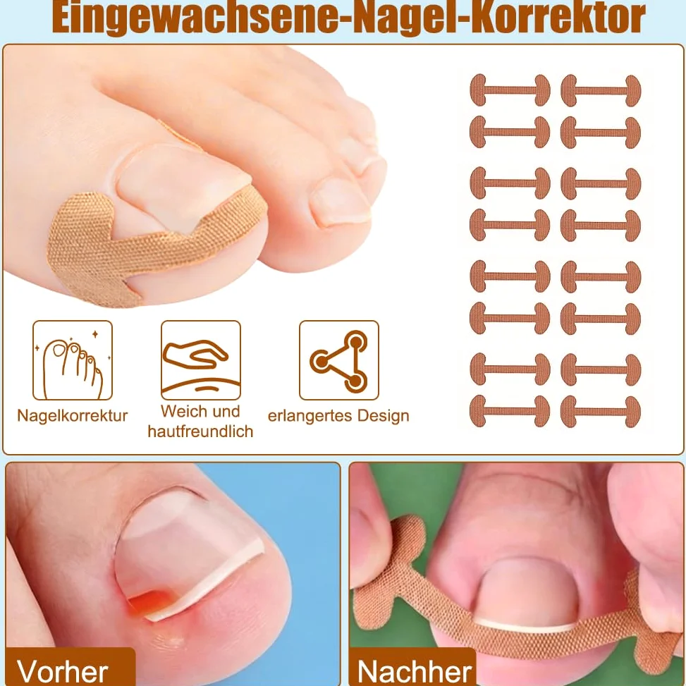 Zestaw do korekcji wrastających paznokci u stóp, 139 sztuk, z łatką do korekcji paznokci u stóp, wkładki do paznokci w kształcie litery C, zestaw narzędzi do pielęgnacji stóp – obcinacz do paznokci
