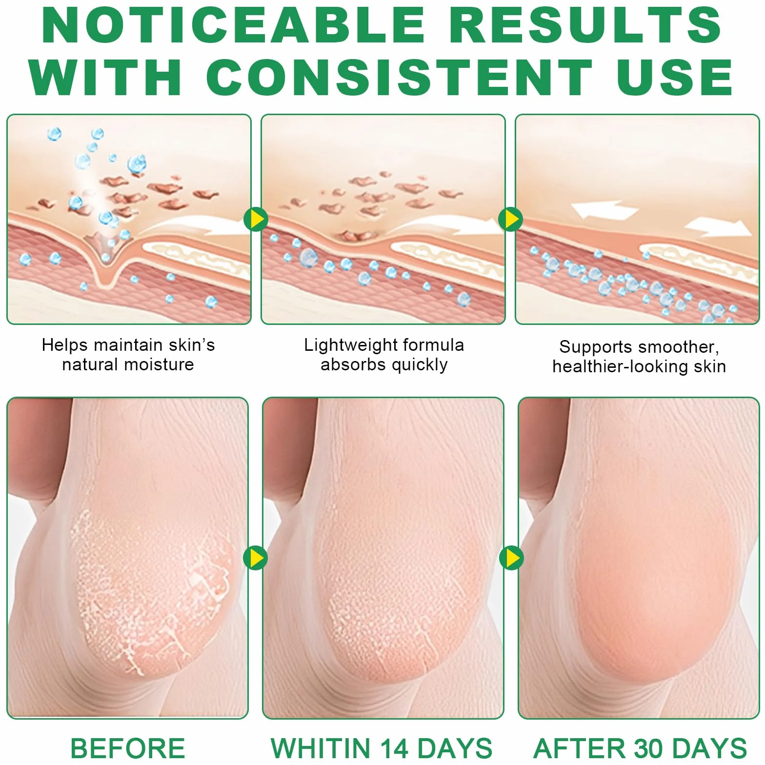 Aloe Vera sztyft do pielęgnacji stóp z 60% mocznikiem, 2-pak – łagodzi suche, popękane pięty, 2% kwas salicylowy, nawilżający balsam do stóp, nawilżający, wegański, nietestowany na zwierzętach