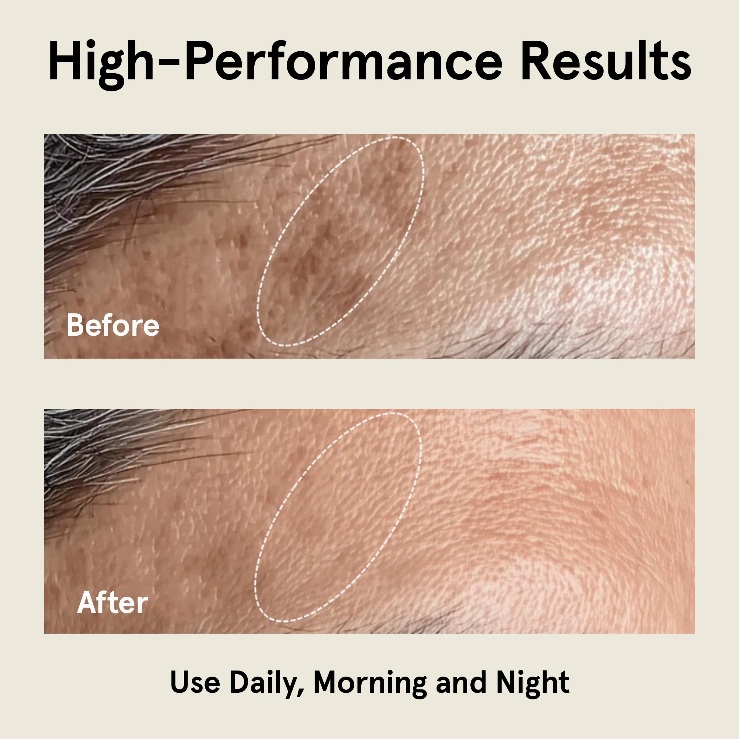 Super serum przeciw starzeniu się skóry na twarz: 5% serum niacynamidowe, bakuchiol, serum z witaminą C do twarzy, serum dla mężczyzn, kwas traneksamiczny, hiperpigmentacja, usuwanie ciemnych plam,