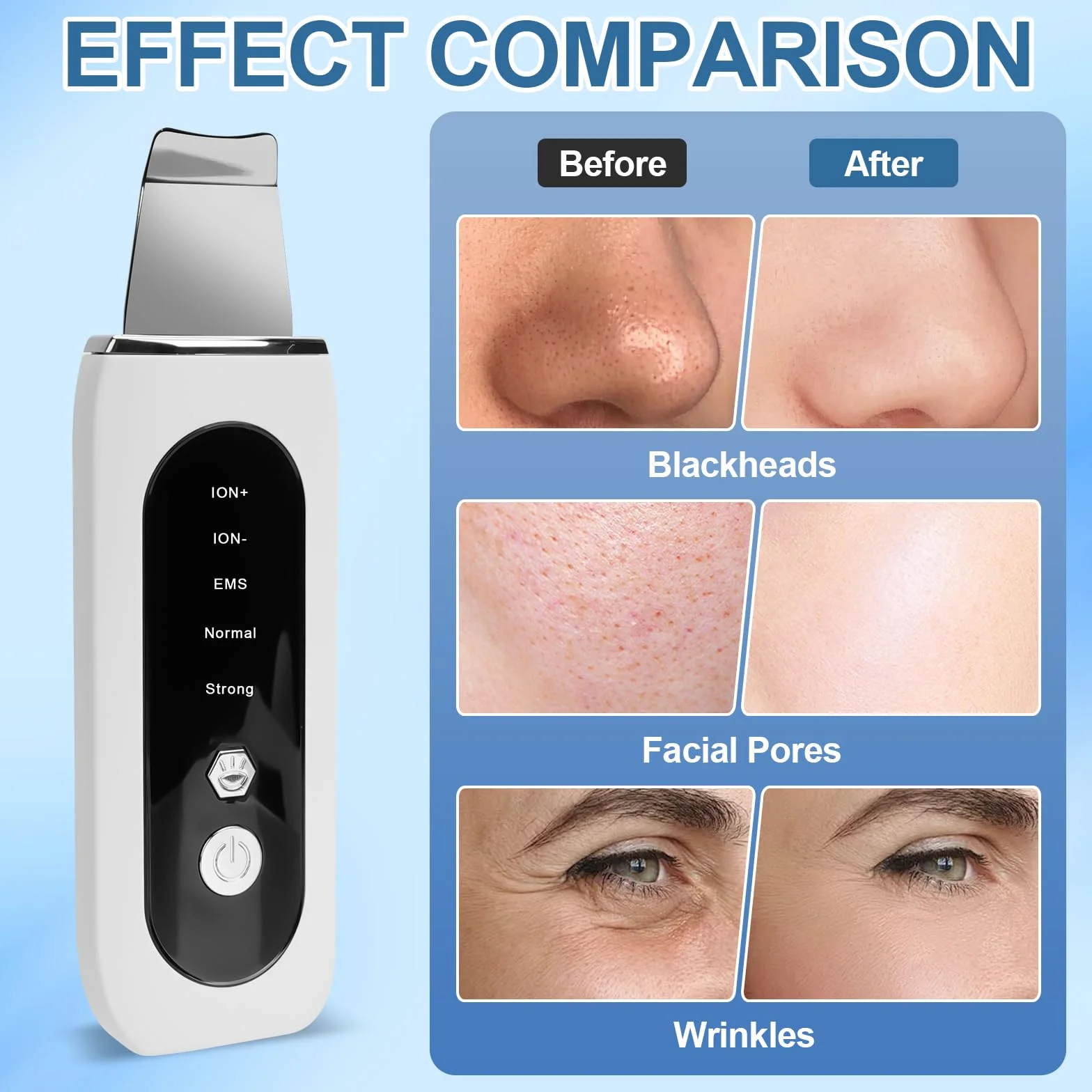 LURICO Skin Scrubber ultradźwiękowe urządzenie do peelingu ultradźwiękowego z 5 trybami pracy i czerwonym światłem, niebieskie światło, oczyszczanie porów, usuwanie wągrów, ultradźwiękowe oczyszczanie