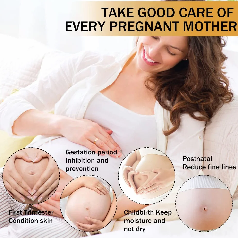 Krem na rozstępy, krem do usuwania blizn, krem do naprawy rozstępów, blizn ciążowych, krem Stretch Marks Cream, 40 g