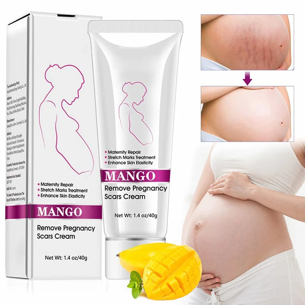Krem na rozstępy, krem do usuwania blizn, krem do naprawy rozstępów, blizn ciążowych, krem Stretch Marks Cream, 40 g