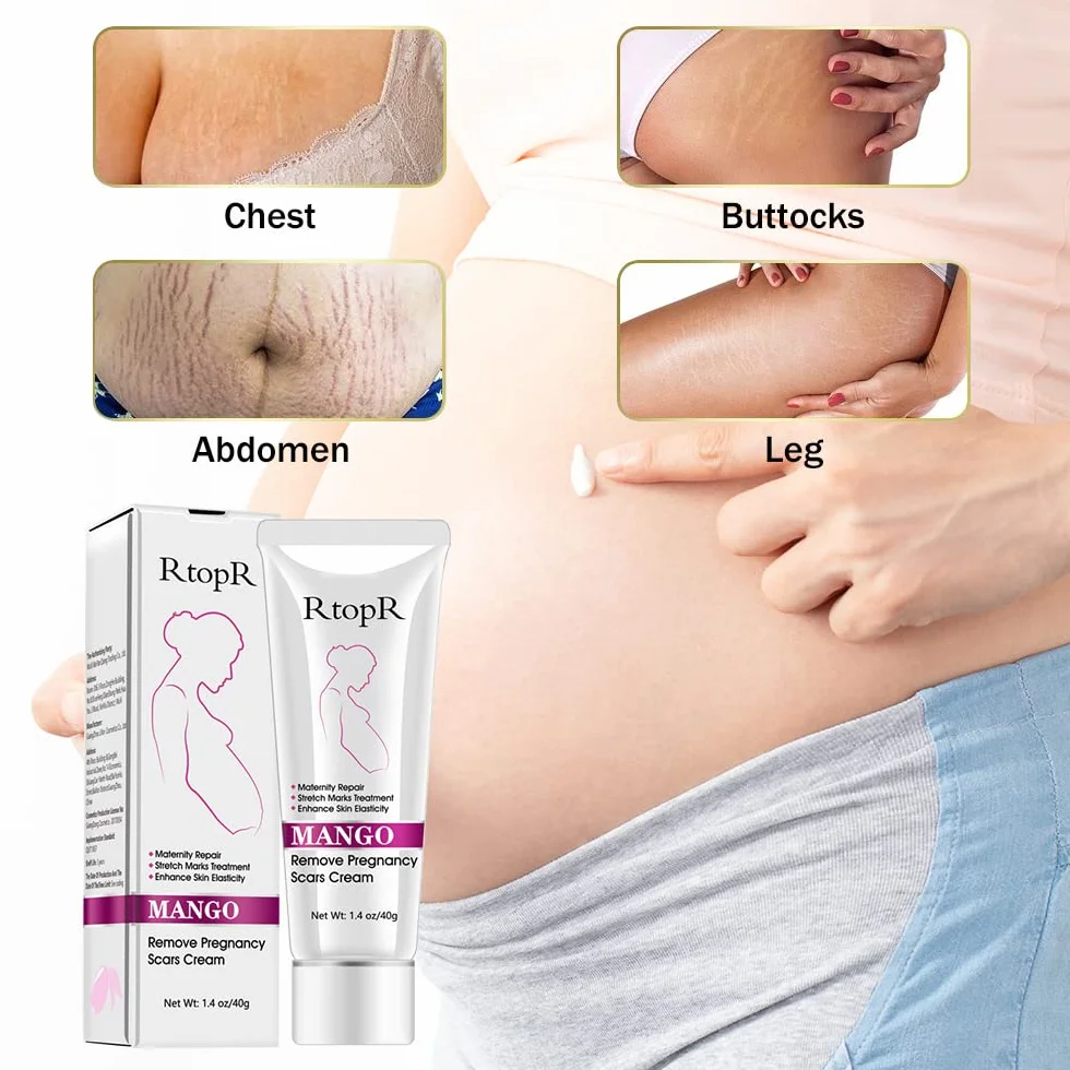 Krem na rozstępy, krem do usuwania blizn, krem do naprawy rozstępów, blizn ciążowych, krem Stretch Marks Cream, 40 g