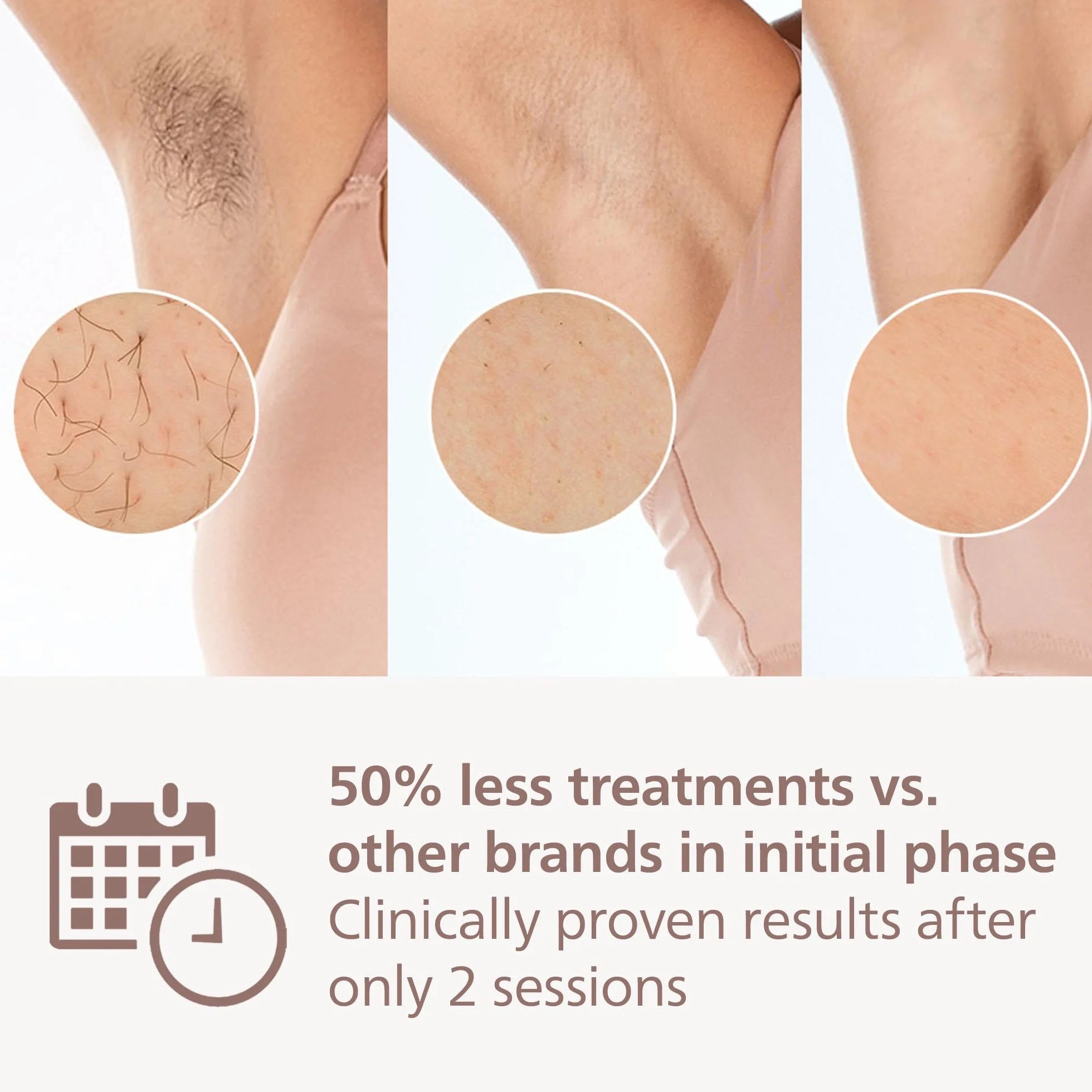 Philips Lumea IPL Prestige, 2 nasadki – urządzenie do usuwania włosów (BRI944/00)