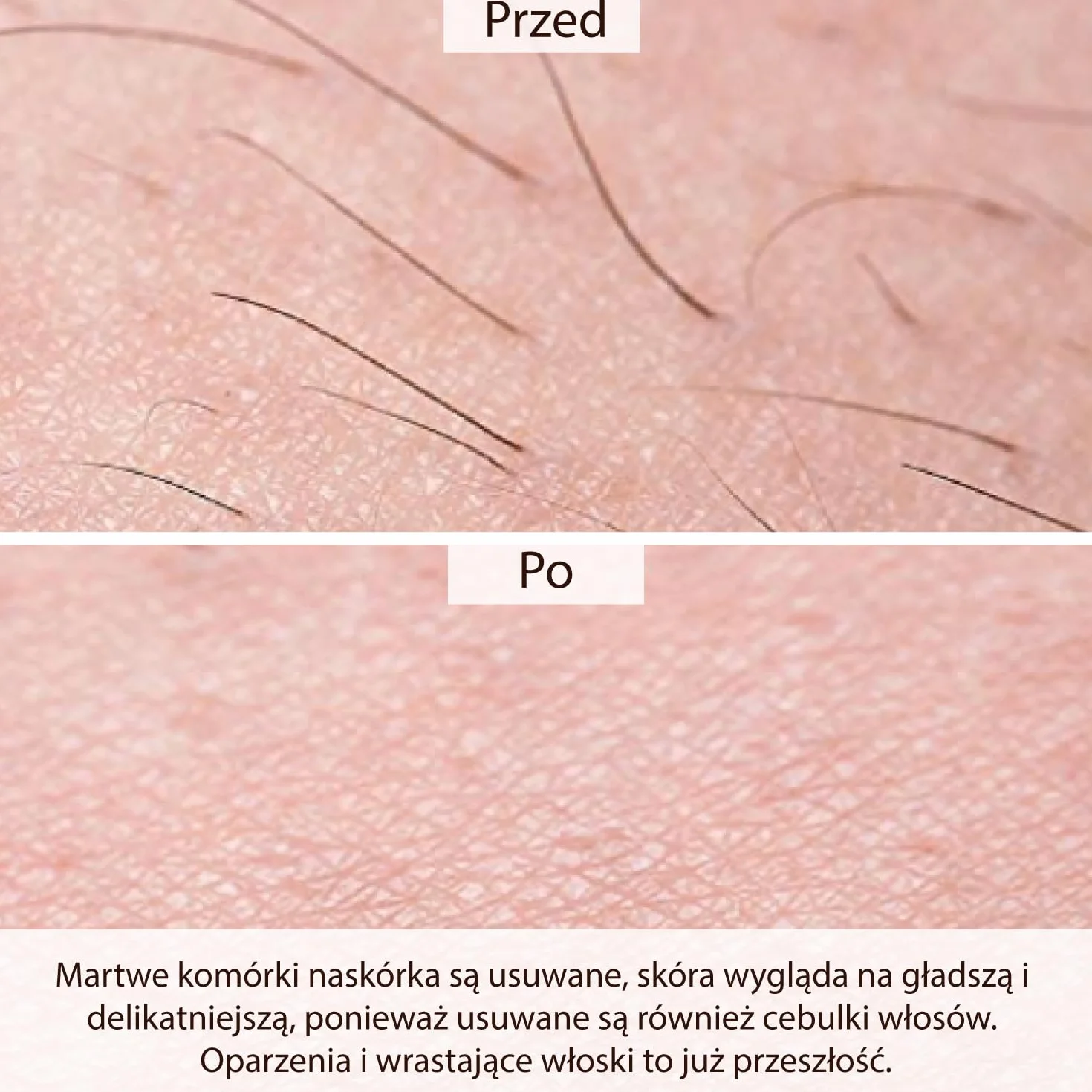 Sugaring Wax Kit - Beauty Sugar Test Set + 50 pasków fizelinowych GRATIS - pasta cukrowa do depilacji - wszystkie trzy pasty w formacie XXL á 600g - do okolic intymnych, twarzy i ciała