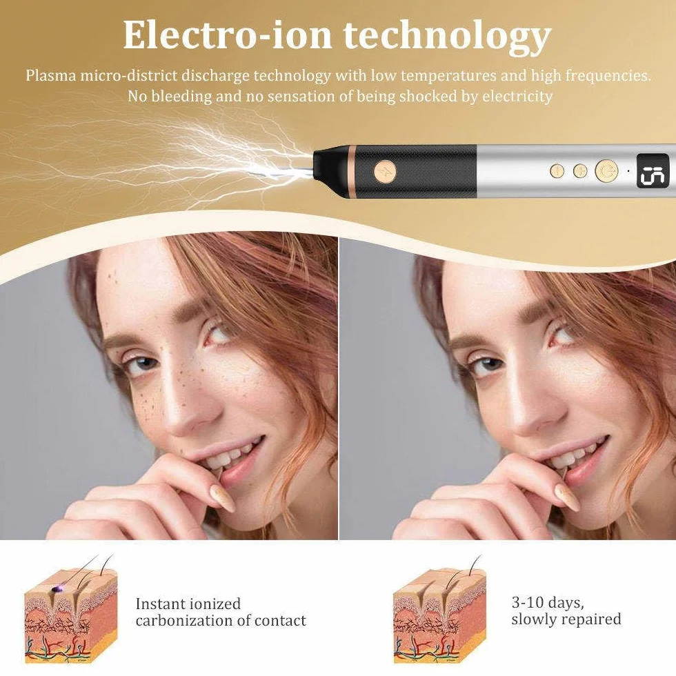 15-Poziomowy Laser Plazmowy Do Usuwania Narośli Skórnych, Brodawek, Pieprzyków, Plam, Piegów, Znamion, Ust, Dłoni, Oczu, Szyi, Twarzy, Głowy, Nosa, Bezpieczny I Bezbolesny, Nie Uszkadza Skóry
