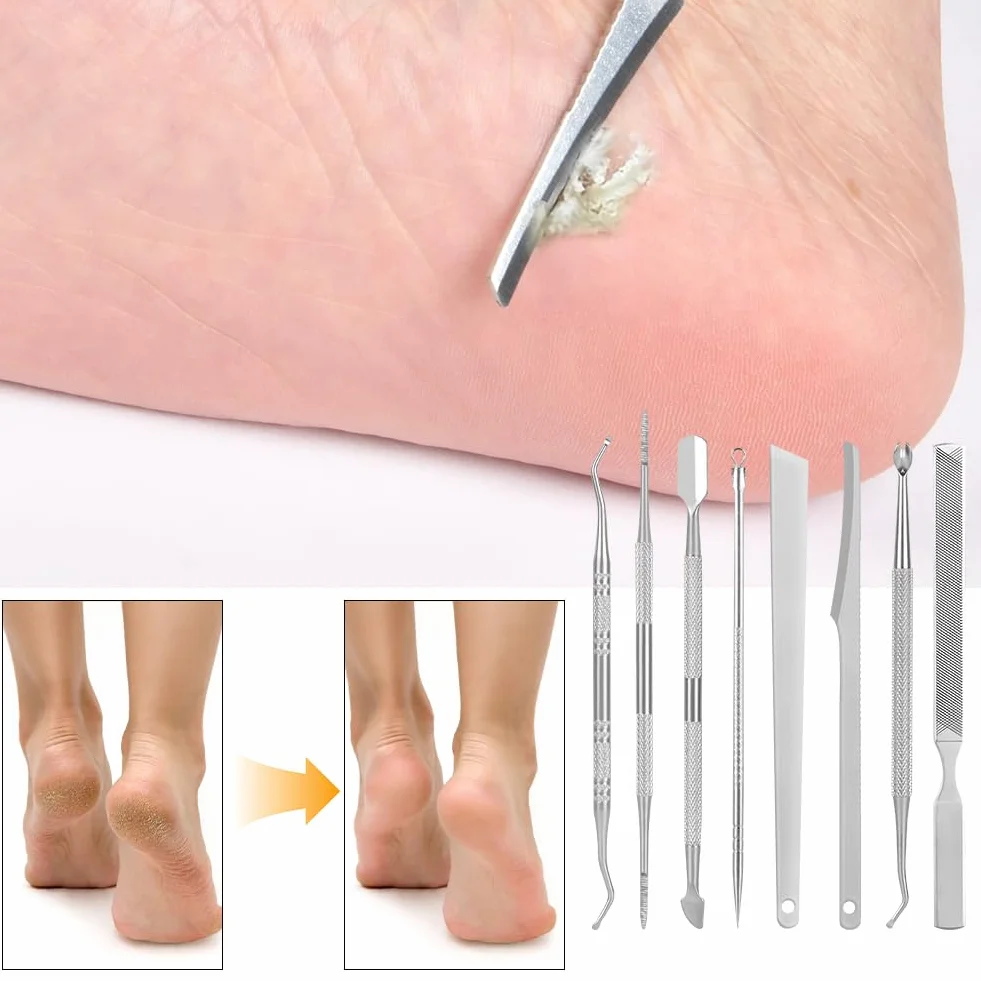 LOPHE Zestaw narzędzi do pedicure, 8-częściowy zestaw do usuwania wcielonych paznokci, profesjonalne noże pedicure, zestaw narzędzi do pedicure ze stali nierdzewnej