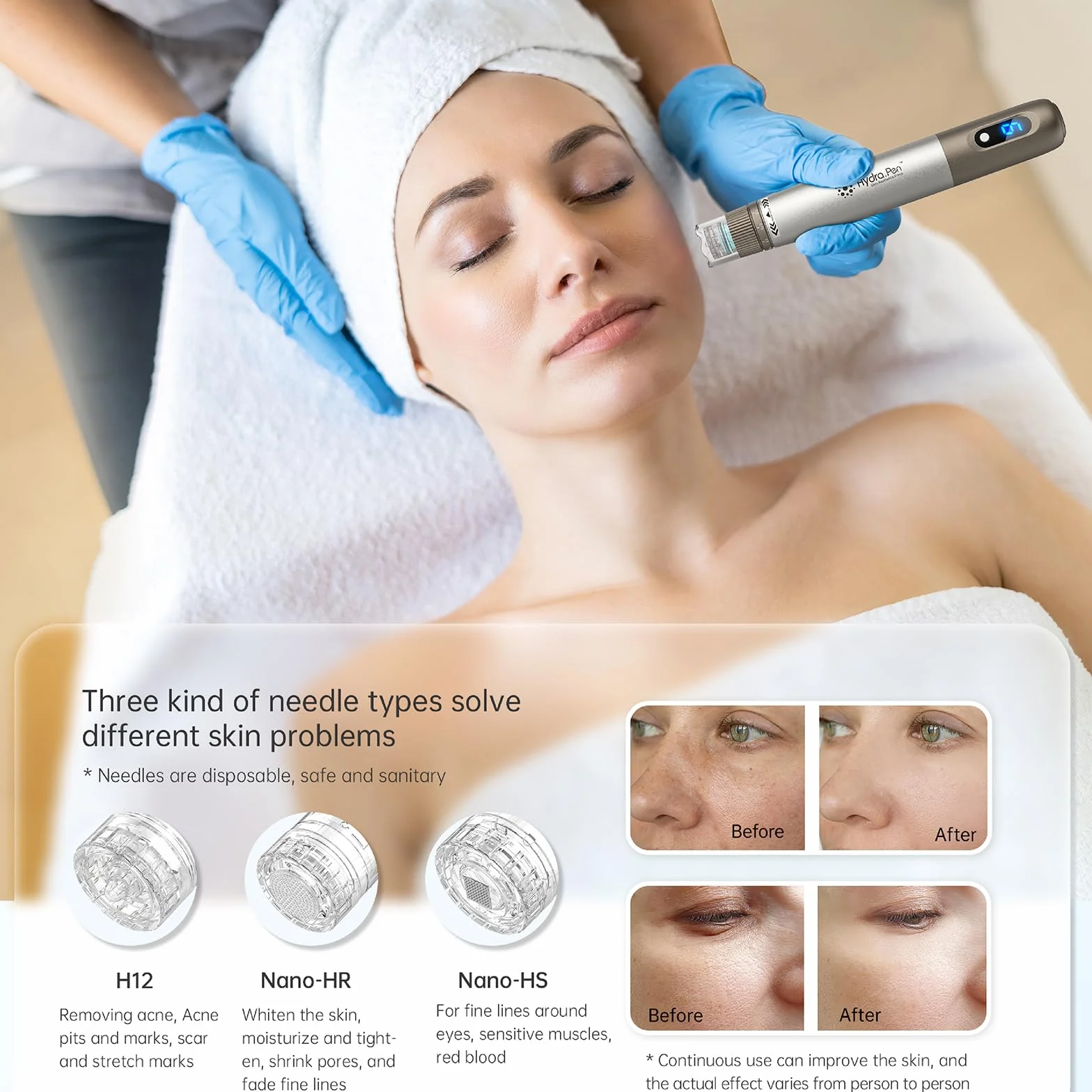 Nano-HS Nano-HS wymienne igły do pisaków mikroigłowych do aplikatora serum Hydra Pen H3 H5, autentyczne jednorazowe igły zastępcze, akcesoria do pielęgnacji skóry (Nano-HS, 15 szt.)
