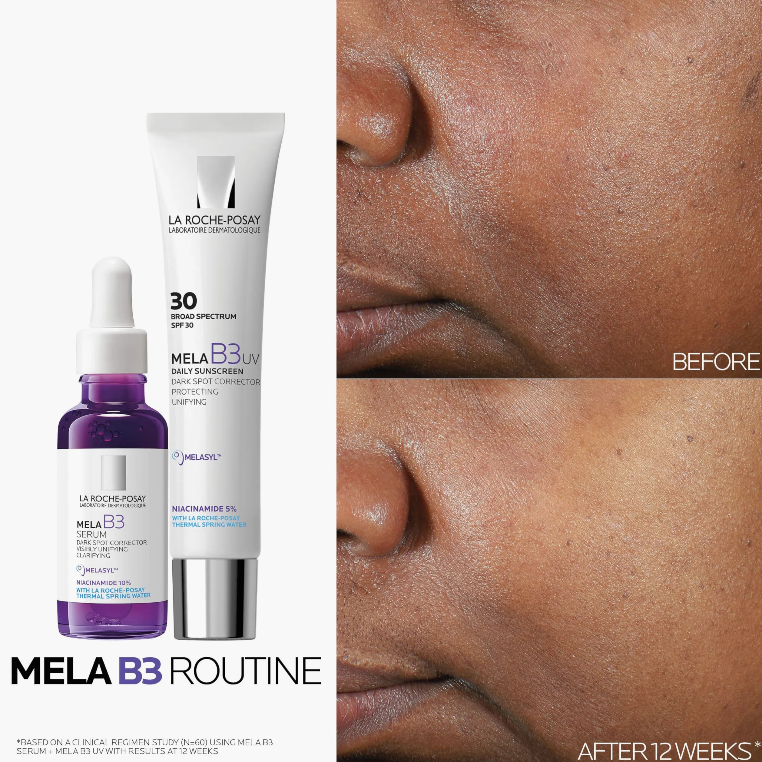 La Roche-Posay Mela B3 serum przeciw plamom pigmentowym, 2 tygodnie przeciw nawrotom, z melasylem i niacynamidem, 50 ml