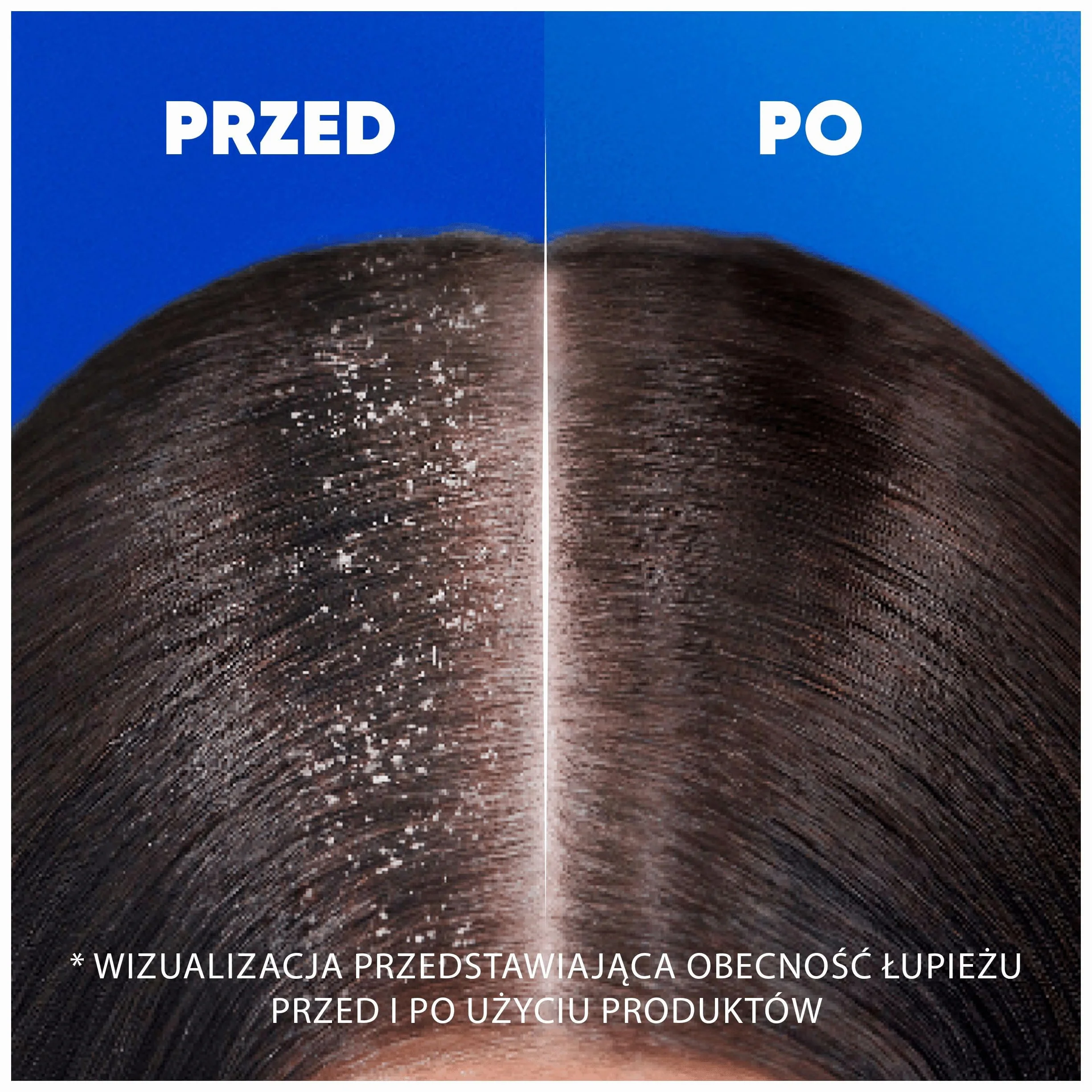 Head and Shoulders Anti Hair Fall Szampon przeciwłupieżowy – usuwa do 100procent łupieżu, 400 ml