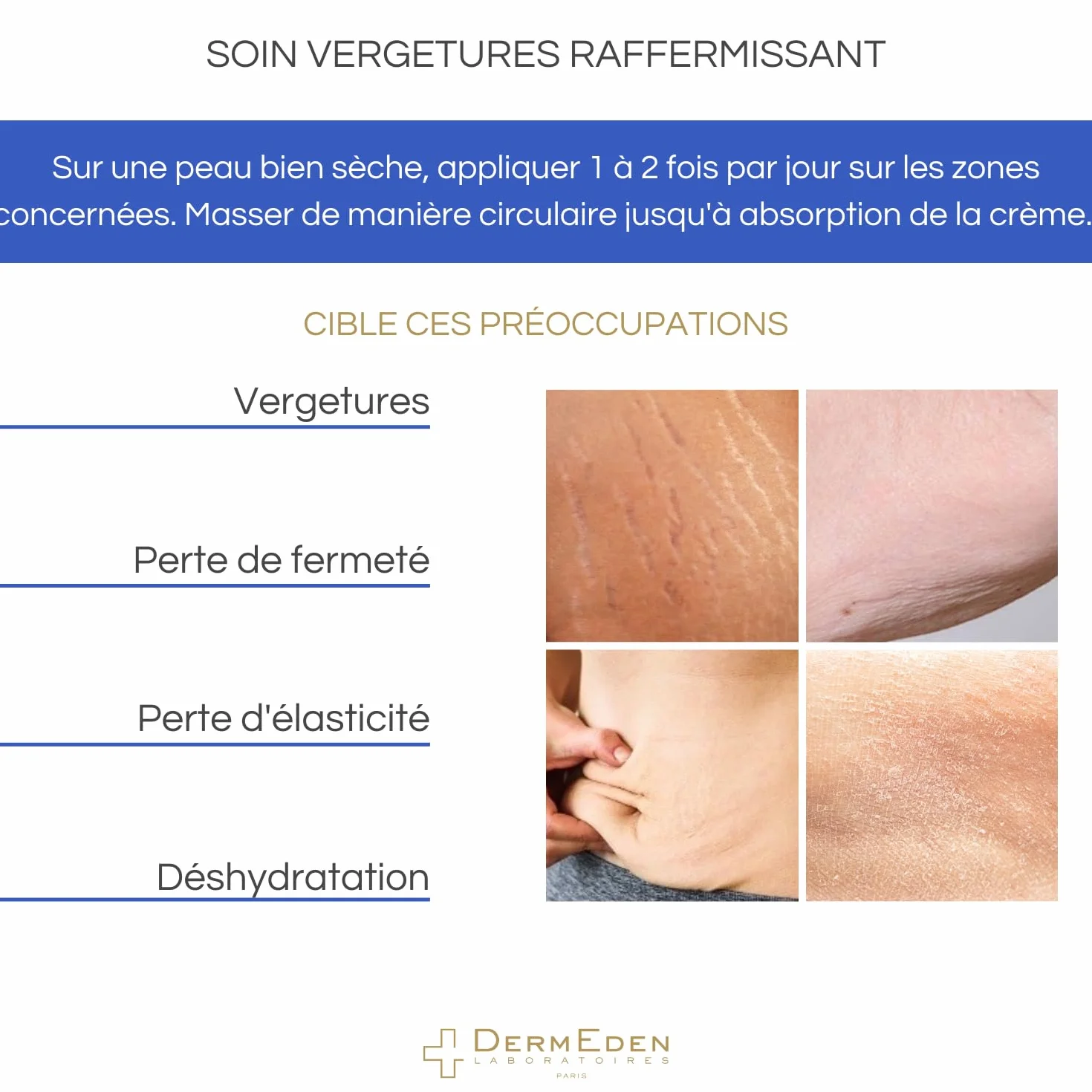 DermEden – Firming Stretch Mark Care 200 ml – działa przeciwko rozstępom i utracie jędrności, nawilża, redukuje i ujędrnia przebarwienia skórne, wyprodukowano we Francji przez nasze laboratoria