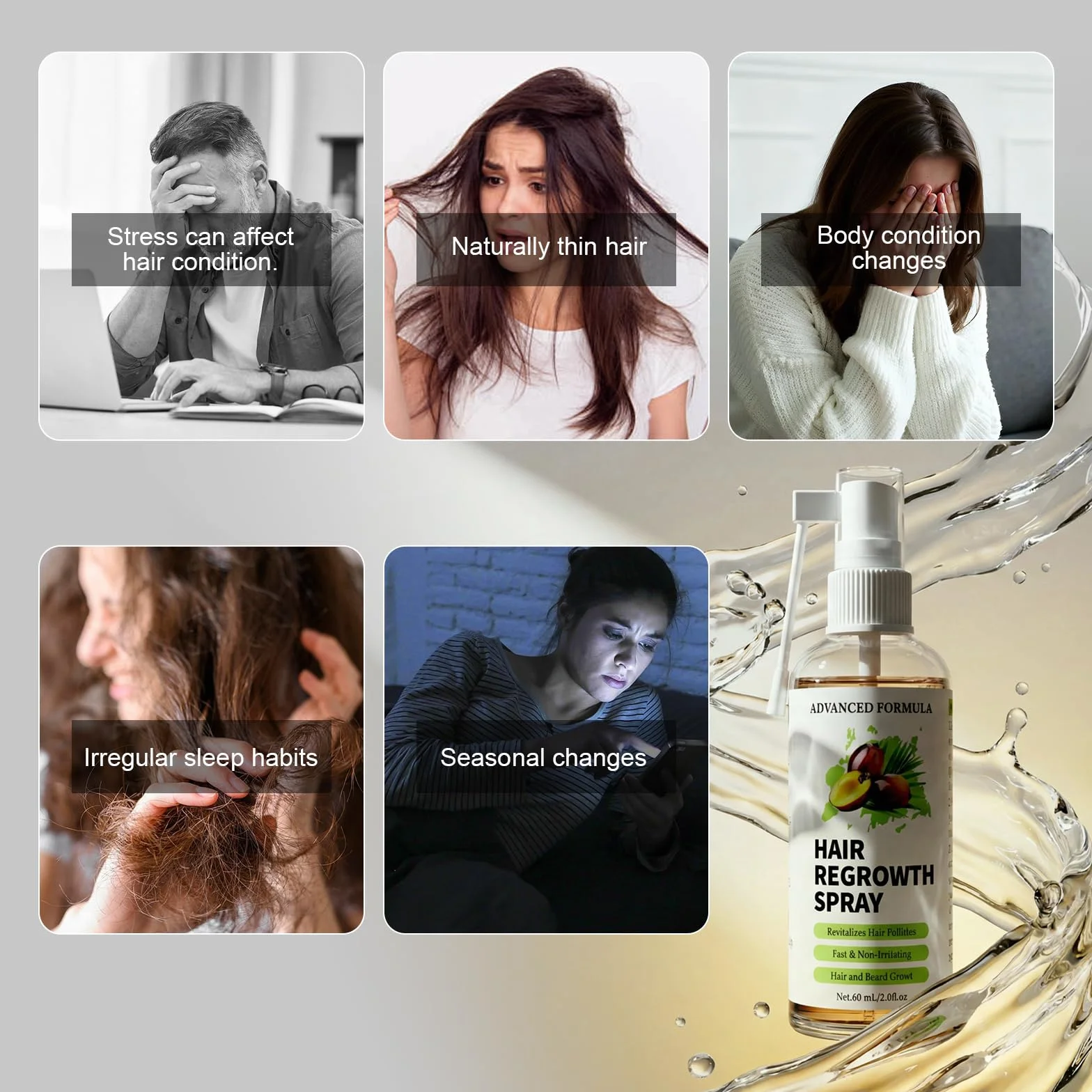 Spray na Porost Włosów z Olejkiem Rozmarynowym, Serum dla Kobiet i Mężczyzn, Wspomaga Pielęgnację przy Wypadaniu Włosów, z Olejem Batana i Rycynowym, Biotyna dla Gęstszych i Mocniejszych Włosów,60 ml