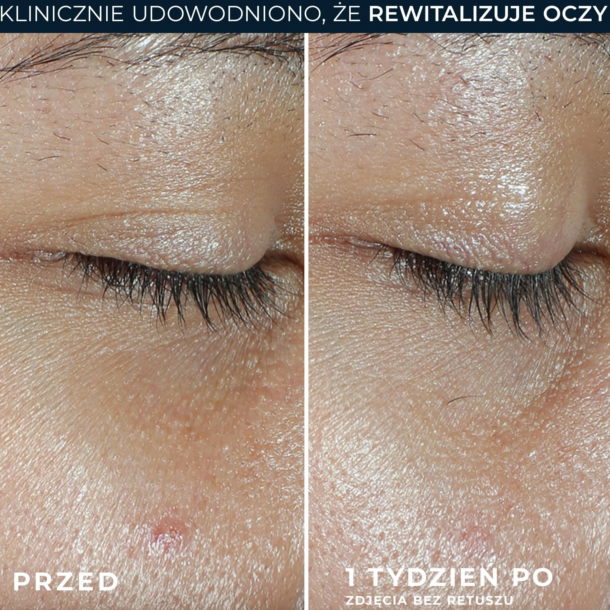 RoC - Balsam do oczu Revive + Glow - 15 ml