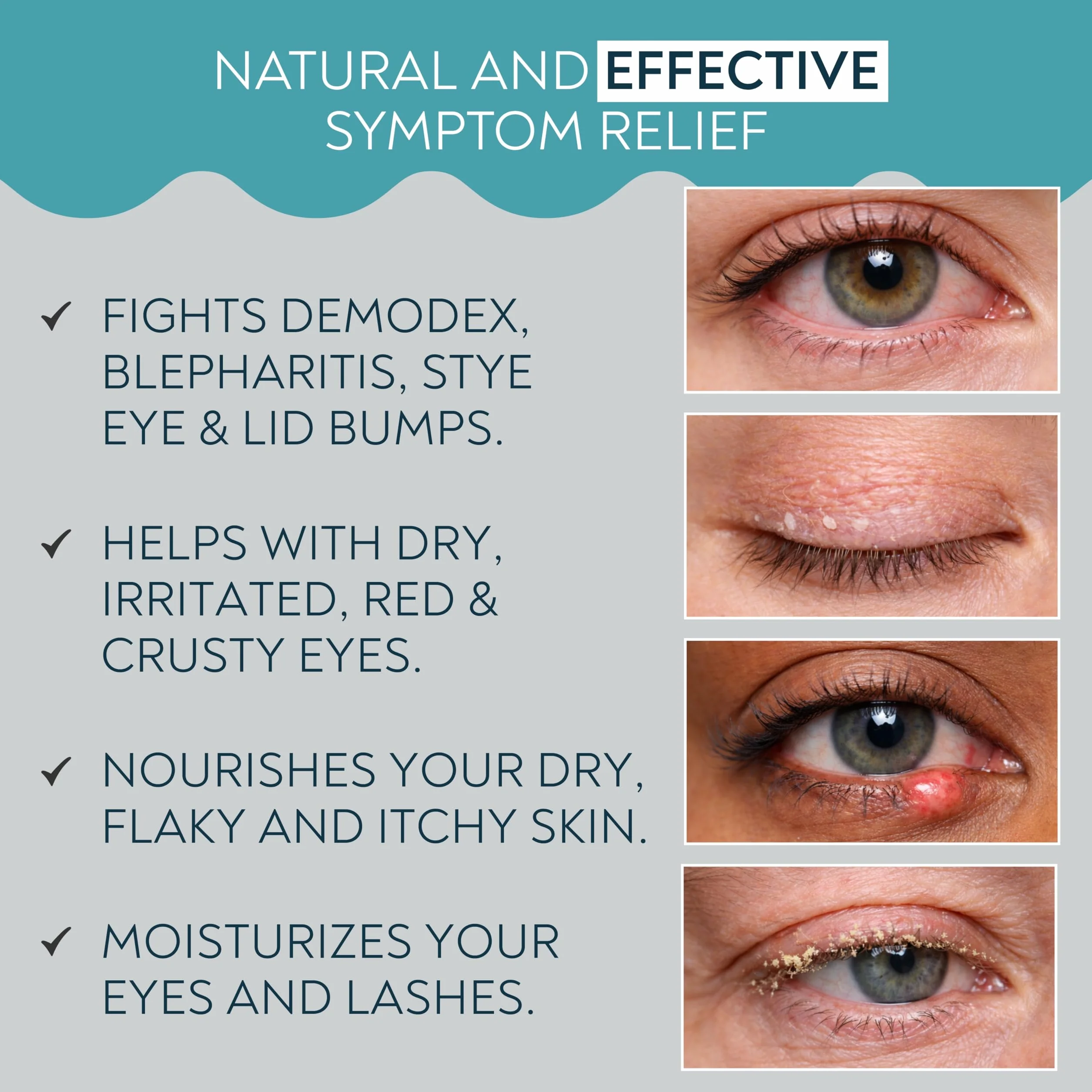 Demodex Eye Cleanser Foam | Extra Strength Tea Tree Oil Formula | Daily Face Wash For Eyelash, Demodex, MGD, Stye Eyes, podrażnienia oczu i wysuszenia skóry, 100 ml