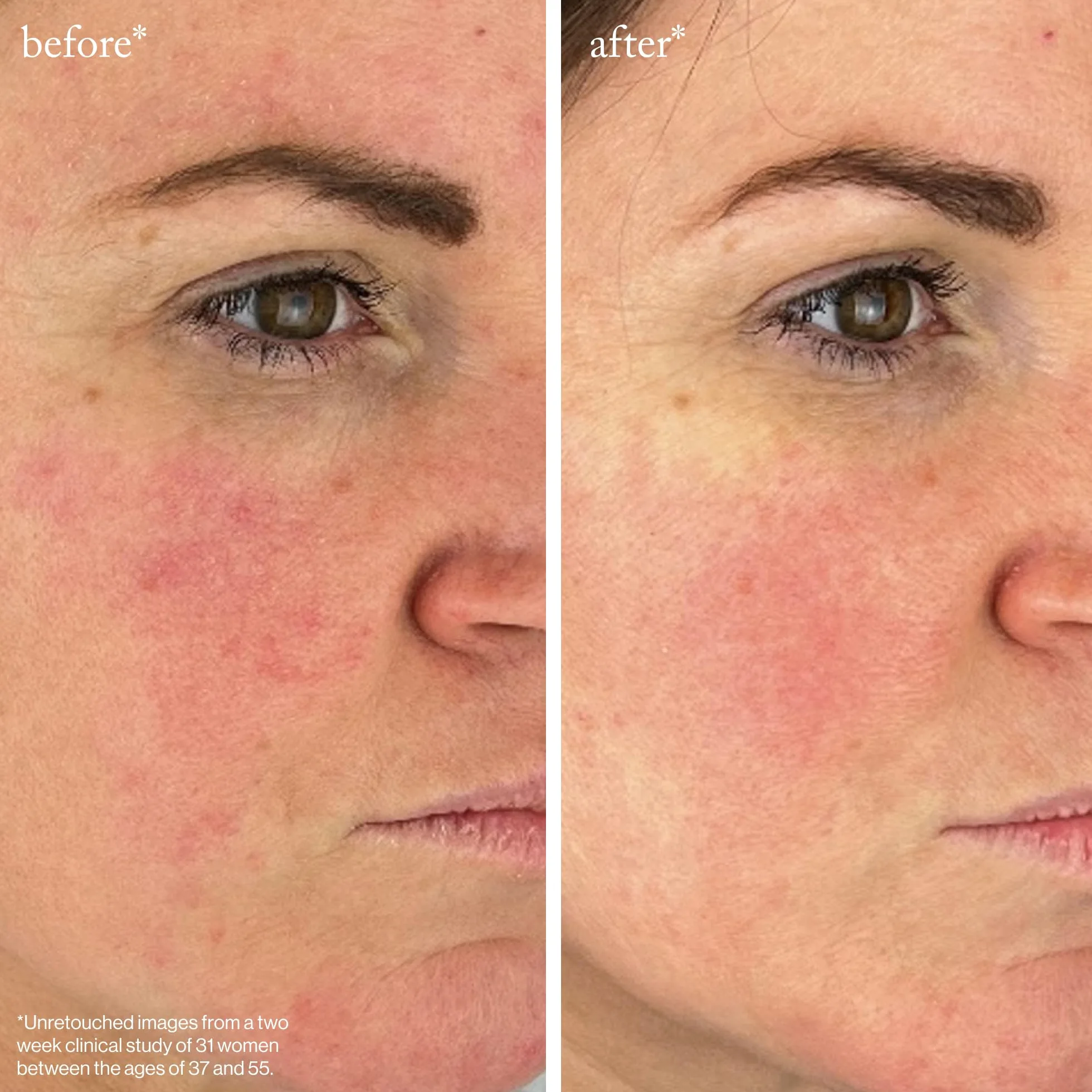 goop Beauty Peptide Serum redukuje drobne linie, zmarszczki i ciemne plamy, peptydy, ceramidy i niacynamid, zabieg przeciwstarzeniowy poprawiający siłę i elastyczność 30 ml