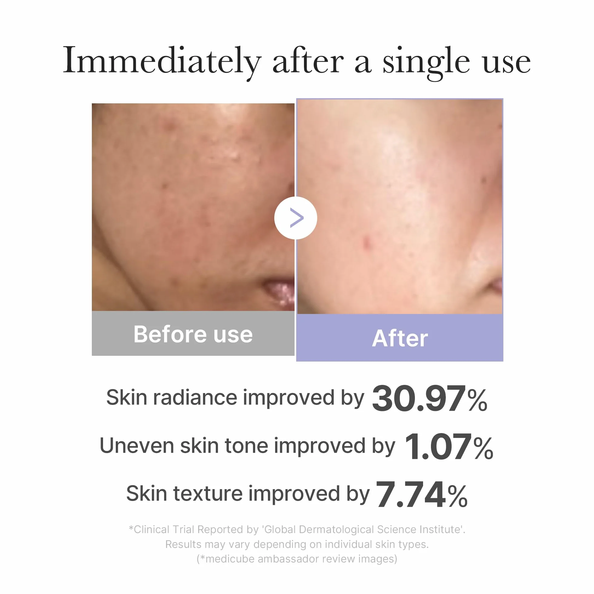 Medicube Booster Pro Mini White | domowe narzędzie do pielęgnacji twarzy - Glow Booster do szklanej skóry, stymulujące wchłanianie pielęgnacji skóry, koreańska pielęgnacja skóry