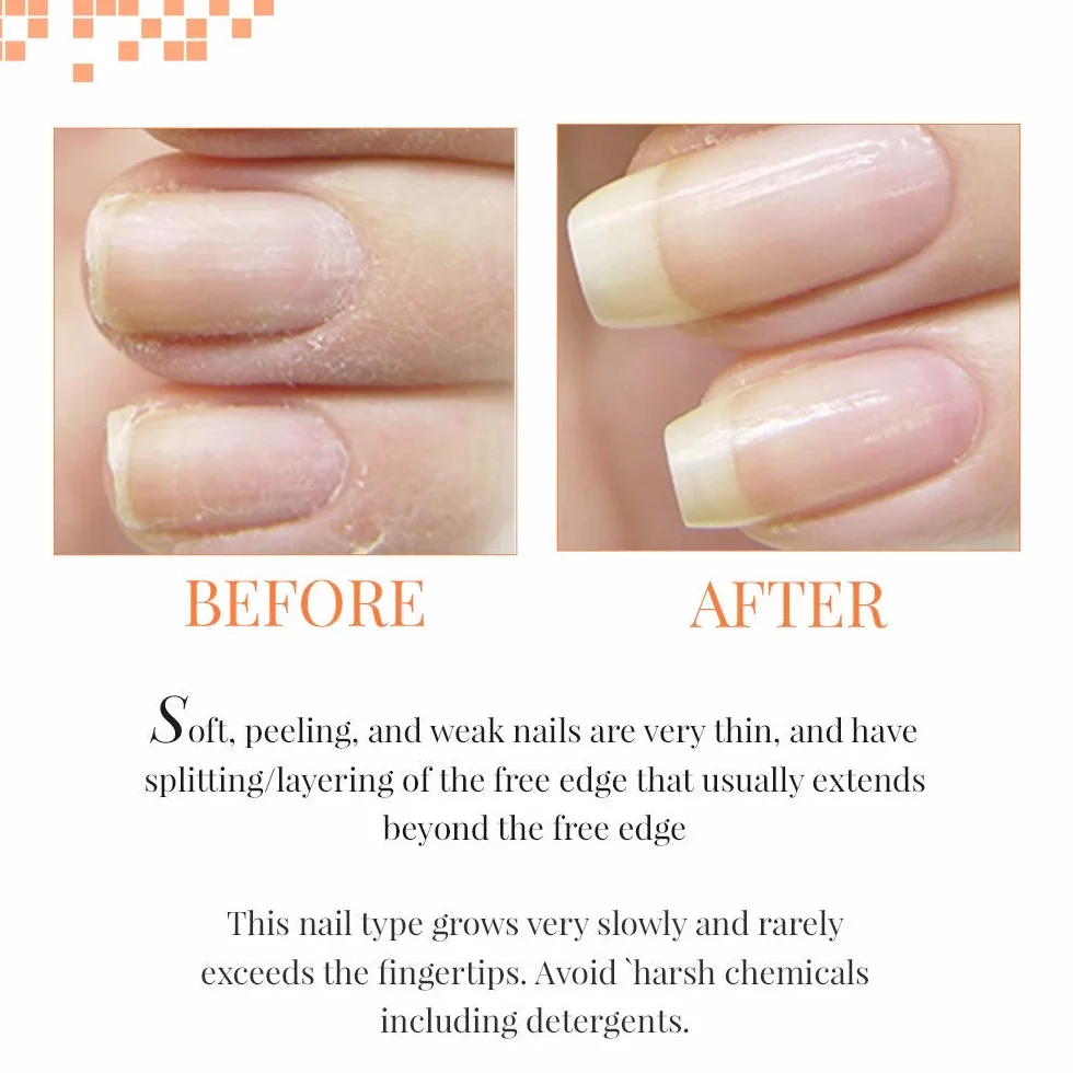 NailTek Foundation II 0.5 oz