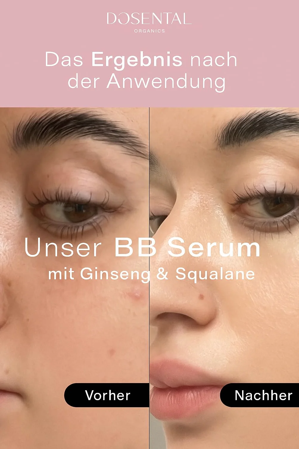 ROSENTAL ORGANICS BB Serum (30ml) - 2-w-1 Makijaż & Pielęgnacja Skóry Skwalan, Aloe Vera & Żeń-szeń - Tonowane Serum do Twarzy - Nawilżająca Pielęgnacja Twarzy - Nowa Formuła (Średnia)