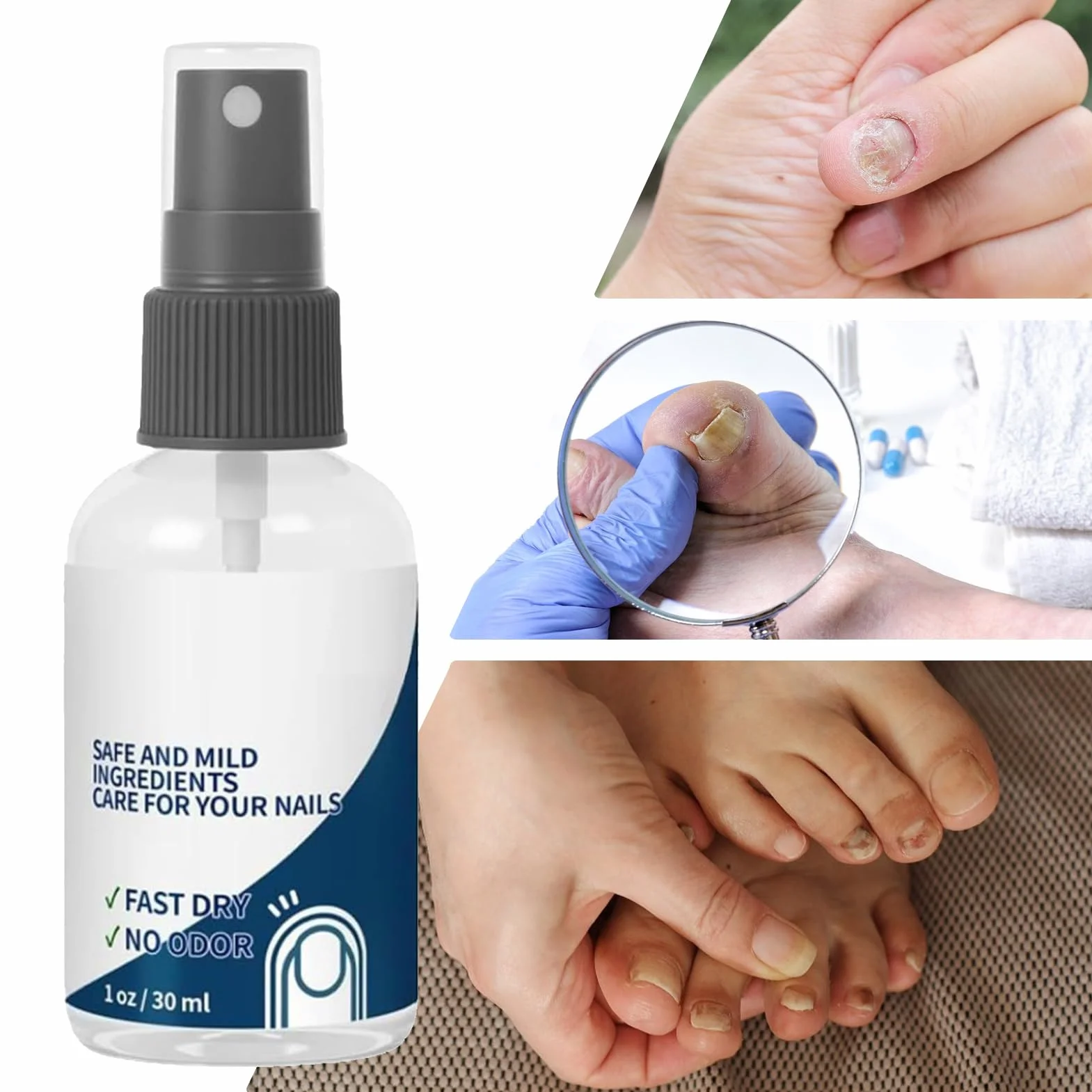 Spray do paznokci - Odżywczy spray naprawczy do paznokci | 30 ml ochronny naturalny szybko działający pielęgnacja paznokci dla mężczyzn podróżny paznokieć dom kobiety zdrowie sportowców swędzenie stóp