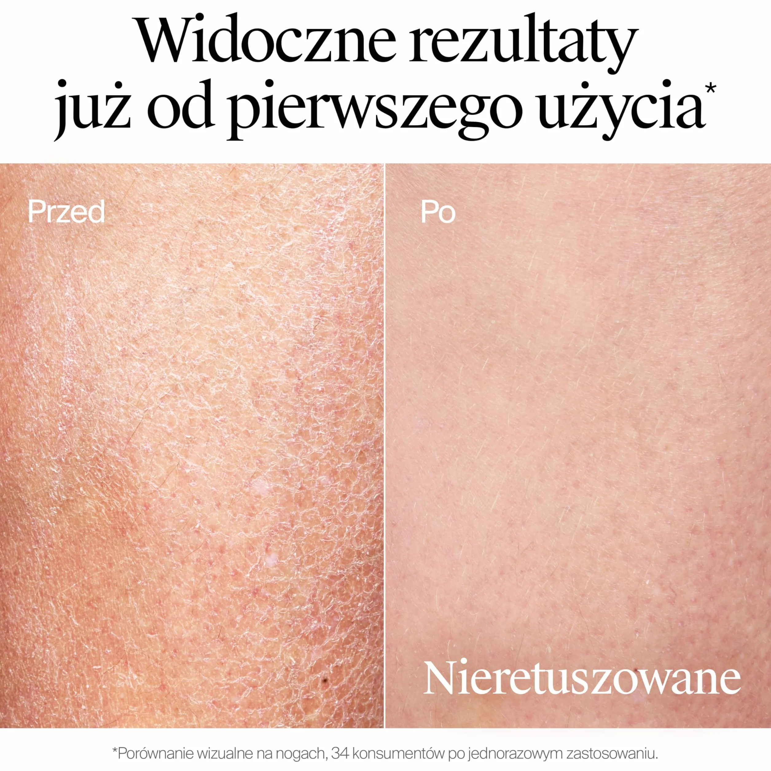 NEUTROGENA® Formuła Norweska® krem do ciała głęboko nawilżający skóra sucha 300ml