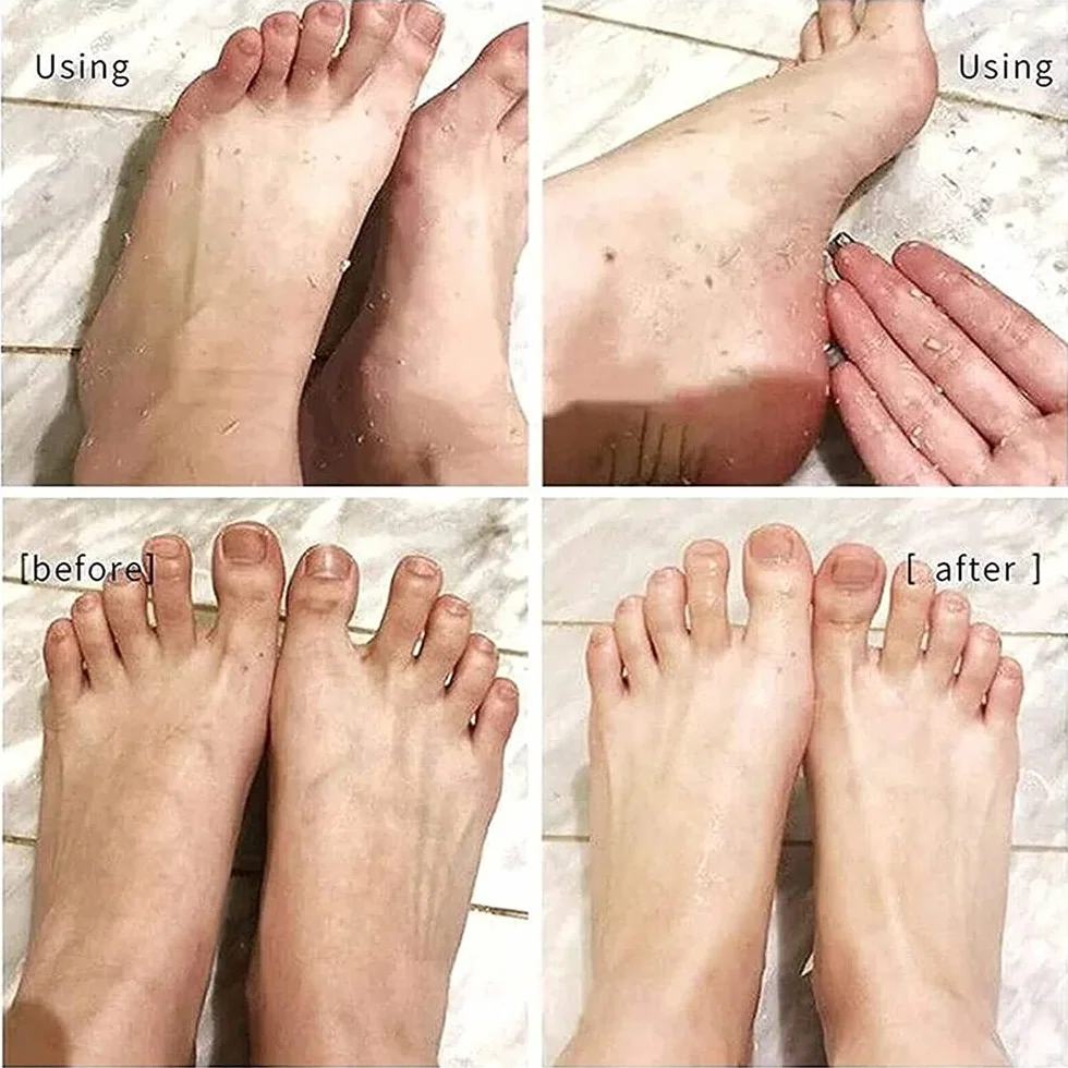 Foot Peel Spray,Foot Peeling Spray Orange Oil,Foot Peeling Spray That Remove Dead Skin,Hydrating Nourish Peel Off Spray,Quickly Remove Dead Skin and Calluses on Feet (Tangerine)