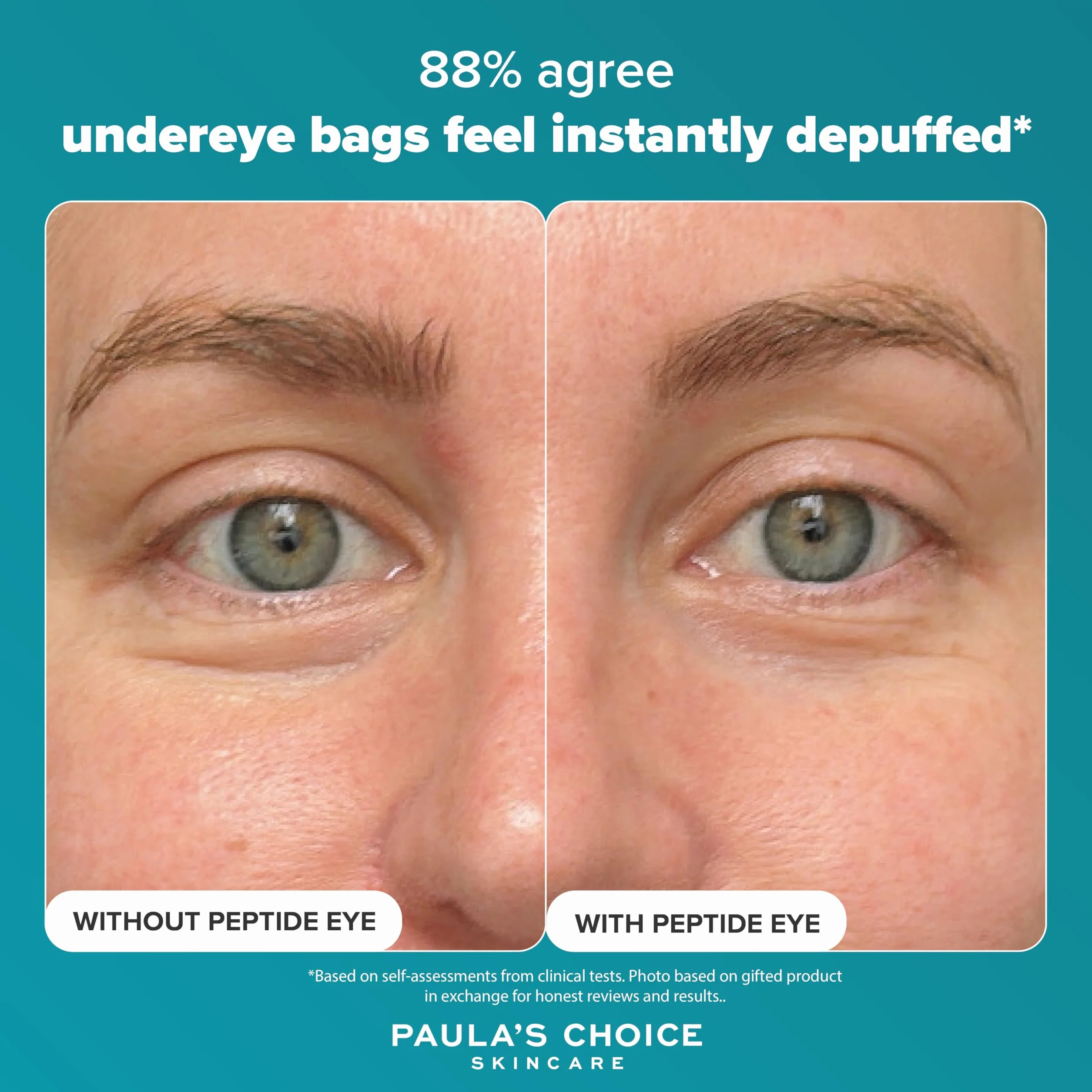 Paula's Choice Pro-Collagen Peptide Serum Pod Oczy - Nawilżający Krem ​Pod Oczy Redukuje Opuchliznę i Ujędrnia – z 4 Peptydami Prokolagenowymi – do Wszystkich Rodzajów Skóry – 15 ml