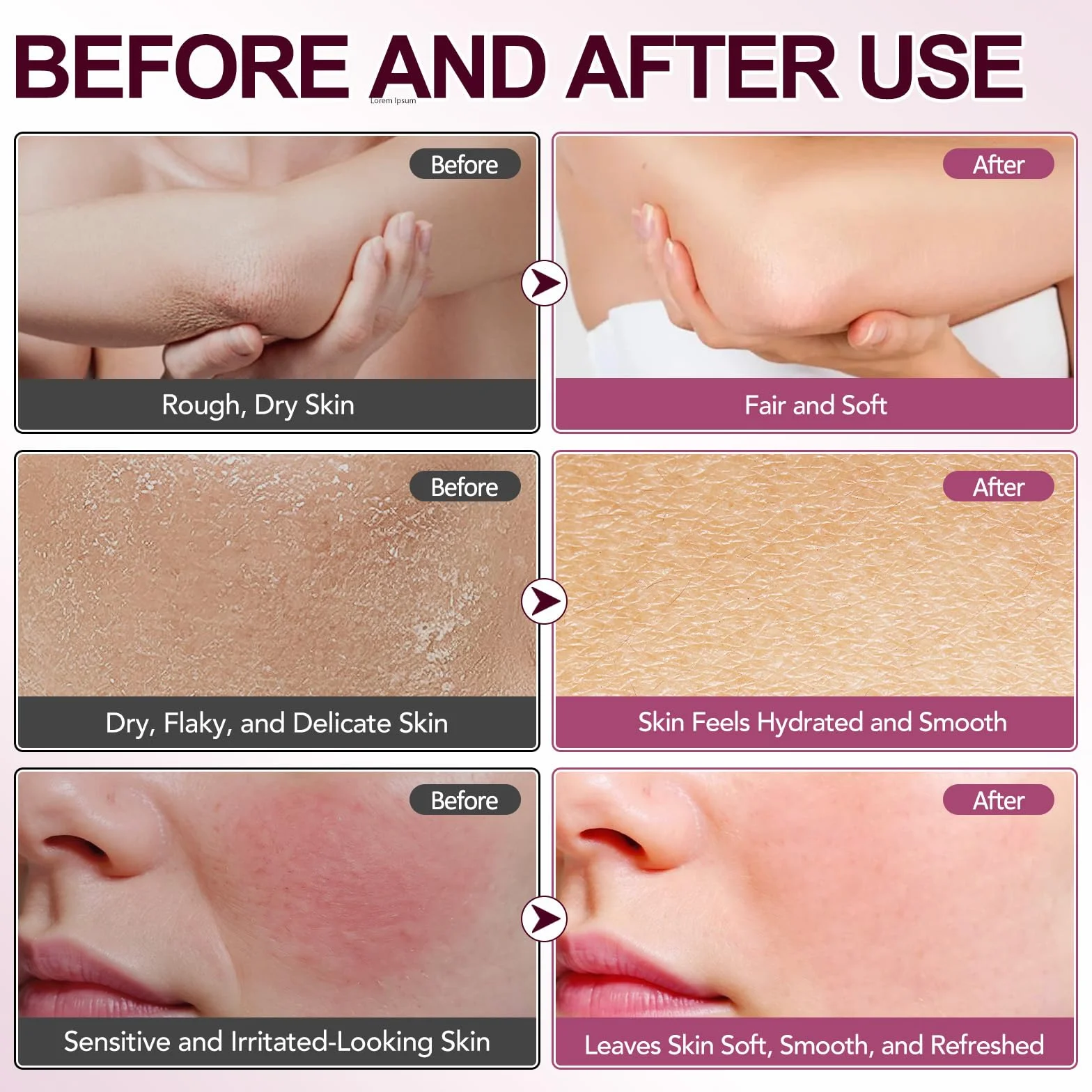 Cemenrete Calcium Volume Multi Balm, Calcium Multi Balm Stick, przeciwzmarszczkowy krem pod oczy przeciw zmarszczkom i drobnej linii, kolagenowy balsam pod oczy, krem nawilżający do oczu, szyi, twarzy