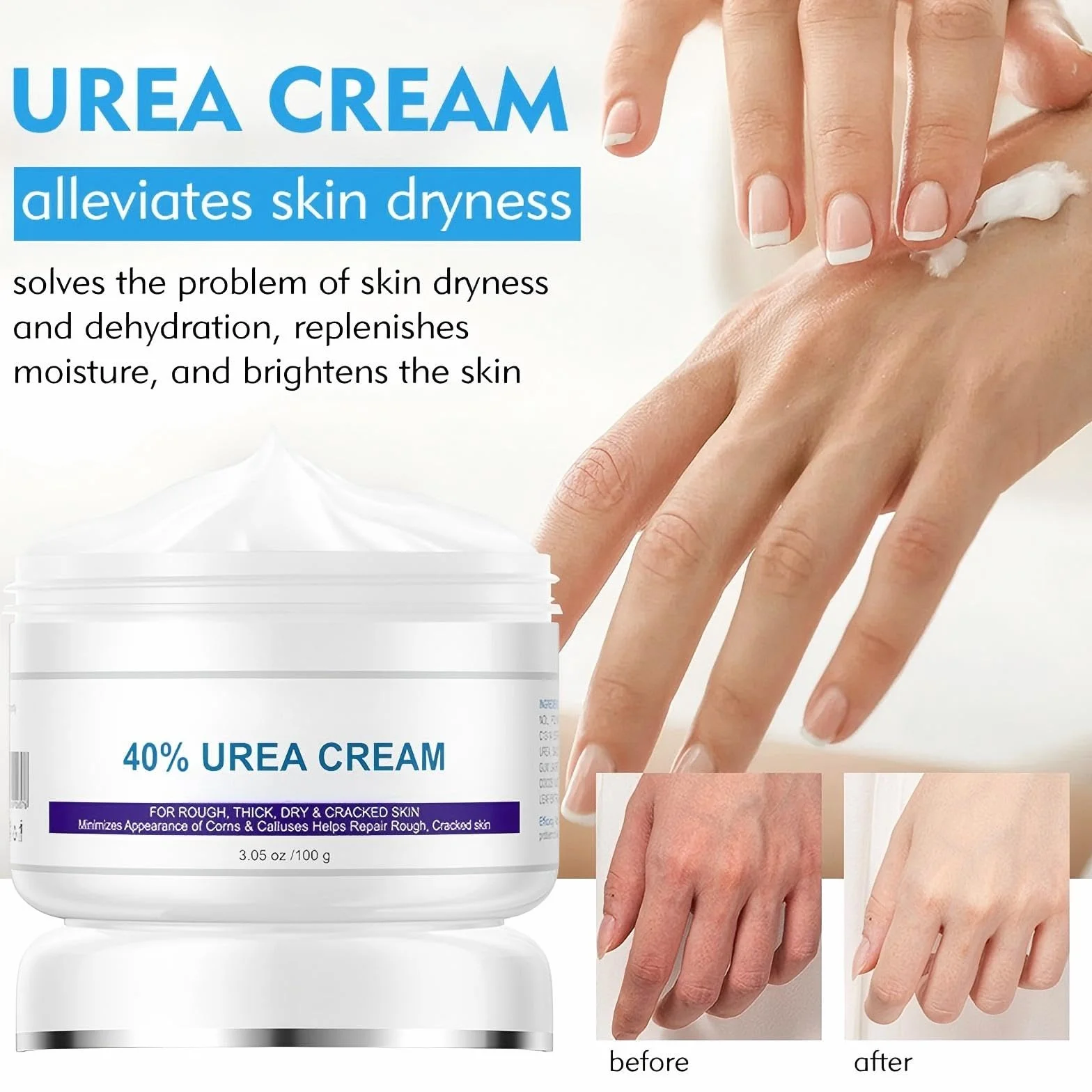Urea Cream 2 szt. 40% krem mocznikowy, peeling i maść na pęknięcia, nawilżający, do dłoni, stóp, twarzy i ciała, usuwa obumarły naskórek
