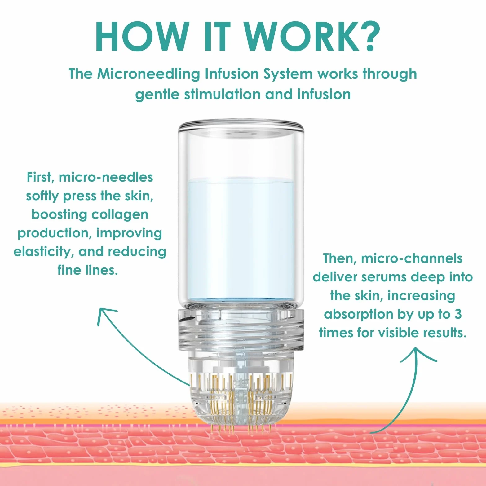 Microneedling zestaw do infuzji, system infuzyjny z igłą Hydra 0,5 mm, 1 szt., 4 zapasowe igły i 5 ampułek z serum przeciw starzeniu się skóry 5 ml, roztwór zapobiegający starzeniu się skóry