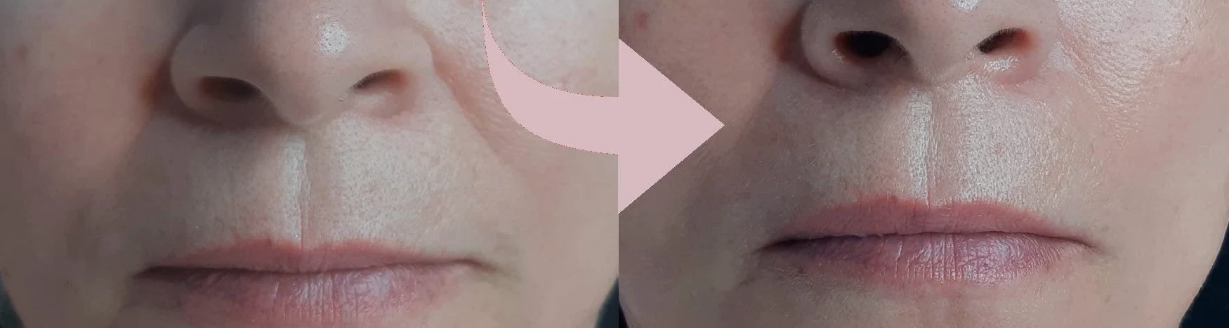 Casmara, krem do twarzy Infinity 50 ml - natychmiastowy efekt liftingu, odmładza dojrzałą skórę i zwalcza głębokie zmarszczki
