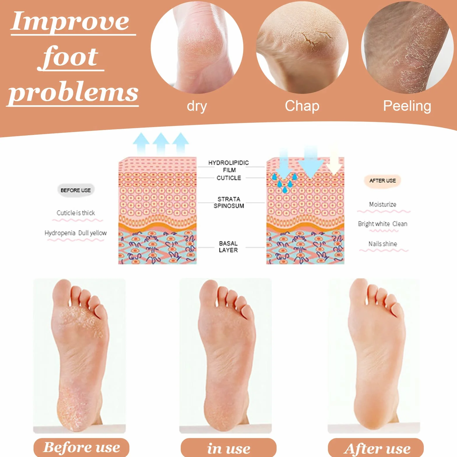 1 para silikonowych skarpet nawilżających, skarpetki żelowe do pedicure, nawilżające skarpetki do stóp, Nocne nawilżające skarpetki do pielęgnacji skóry stóp, silikonowe skarpetki (A)