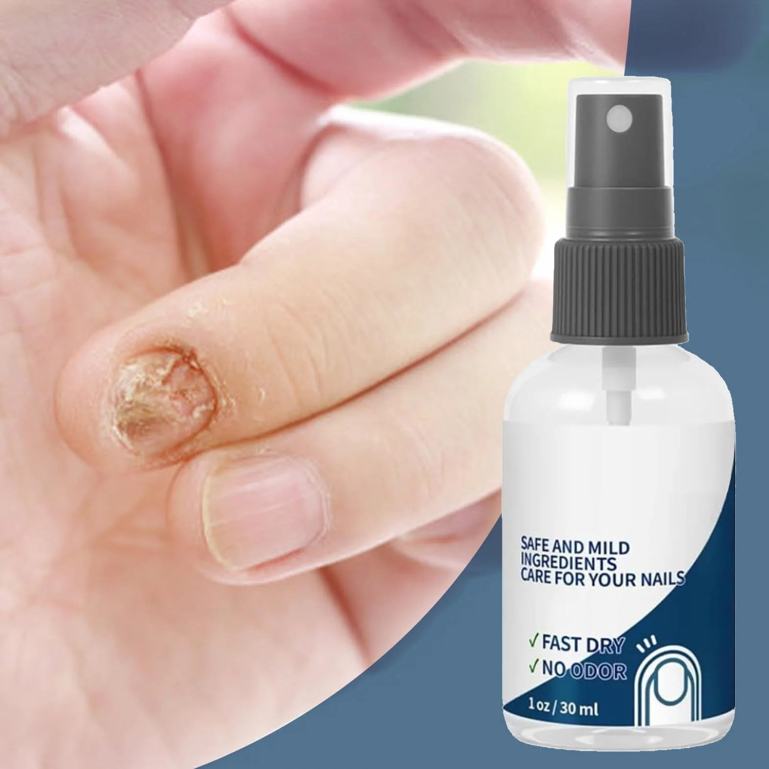 Spray do paznokci - Odżywczy spray naprawczy do paznokci | 30 ml ochronny naturalny szybko działający pielęgnacja paznokci dla mężczyzn podróżny paznokieć dom kobiety zdrowie sportowców swędzenie stóp