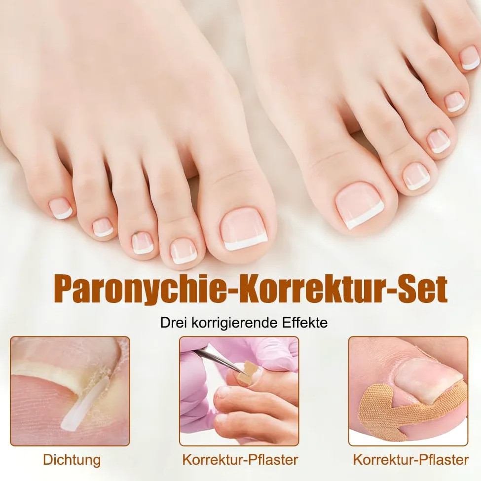 Zestaw do korekcji wrastających paznokci u stóp, 139 sztuk, z łatką do korekcji paznokci u stóp, wkładki do paznokci w kształcie litery C, zestaw narzędzi do pielęgnacji stóp – obcinacz do paznokci