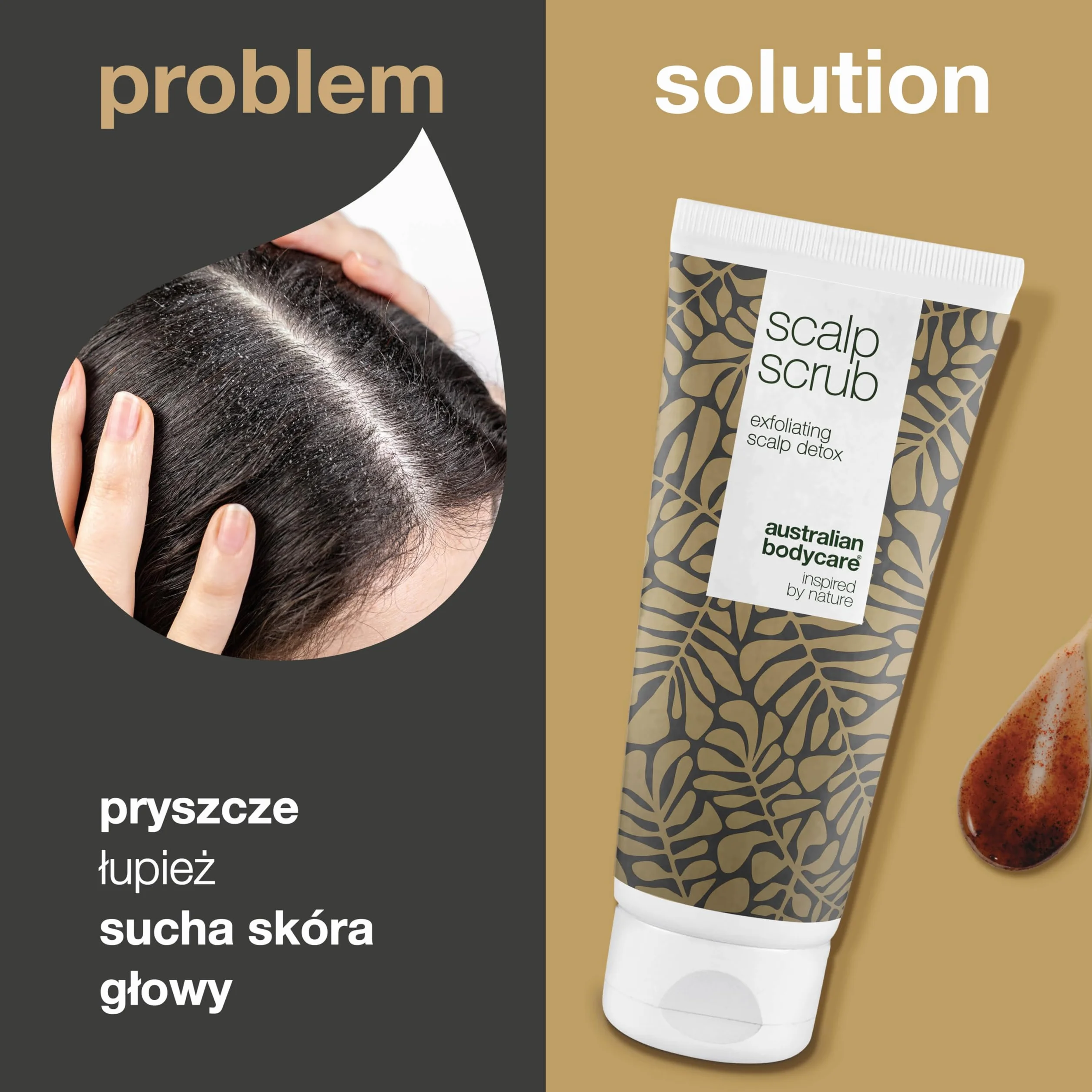 Peeling skóry głowy na pryszcze na skórze głowy - Skuteczny na pryszcze na skórze głowy, na linii włosów lub na guzki na skórze głowy - Peeling na skórę głowy Swędząca skóra głowy i łupież, 200 ml
