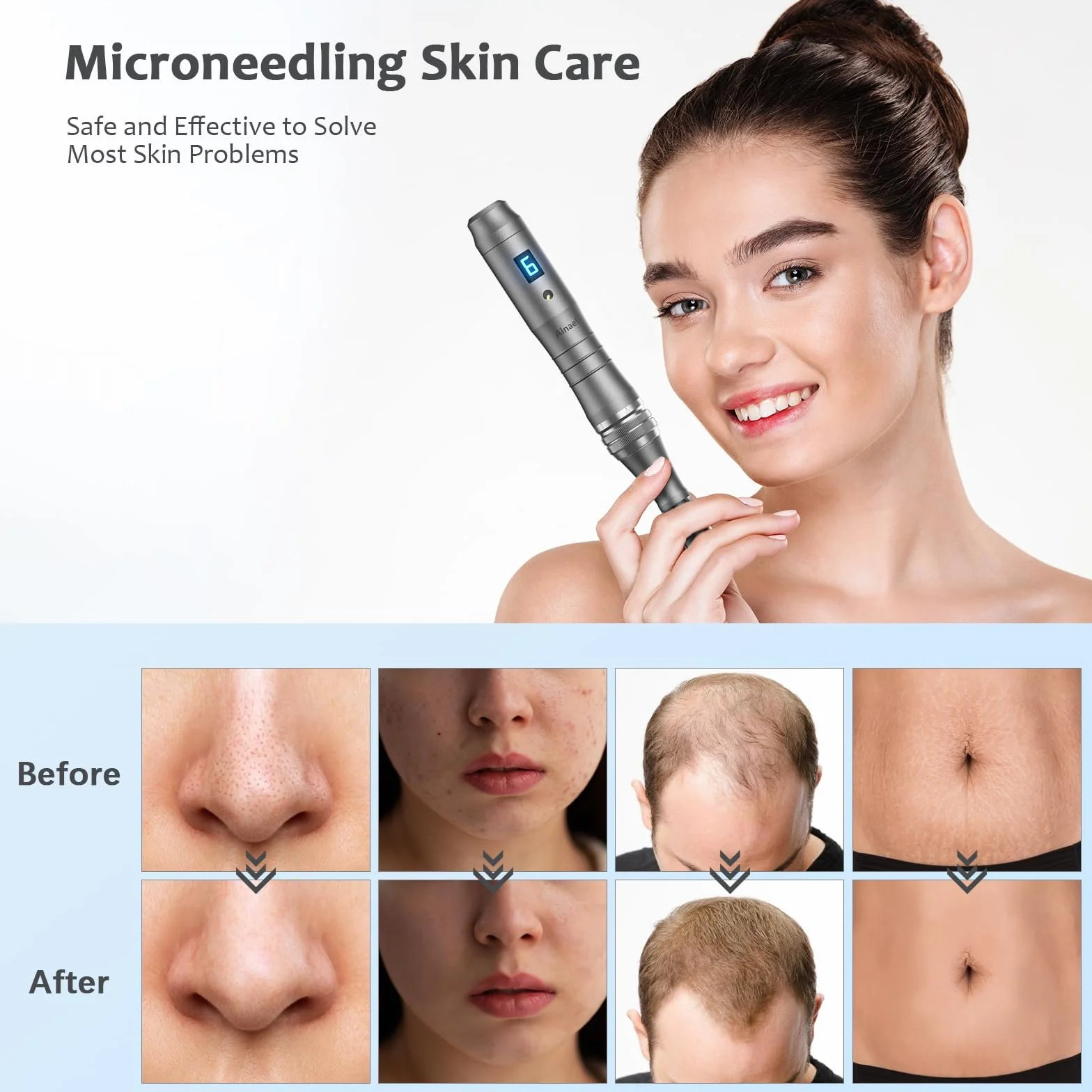 Ultima M8 Microneedling Pen, Professional Wireless Microneedle Machine Electric Adjustable Microneedling Pen Kit for Face Body Hair Beard Growth Gift for Women -12 Replacement Cartridges