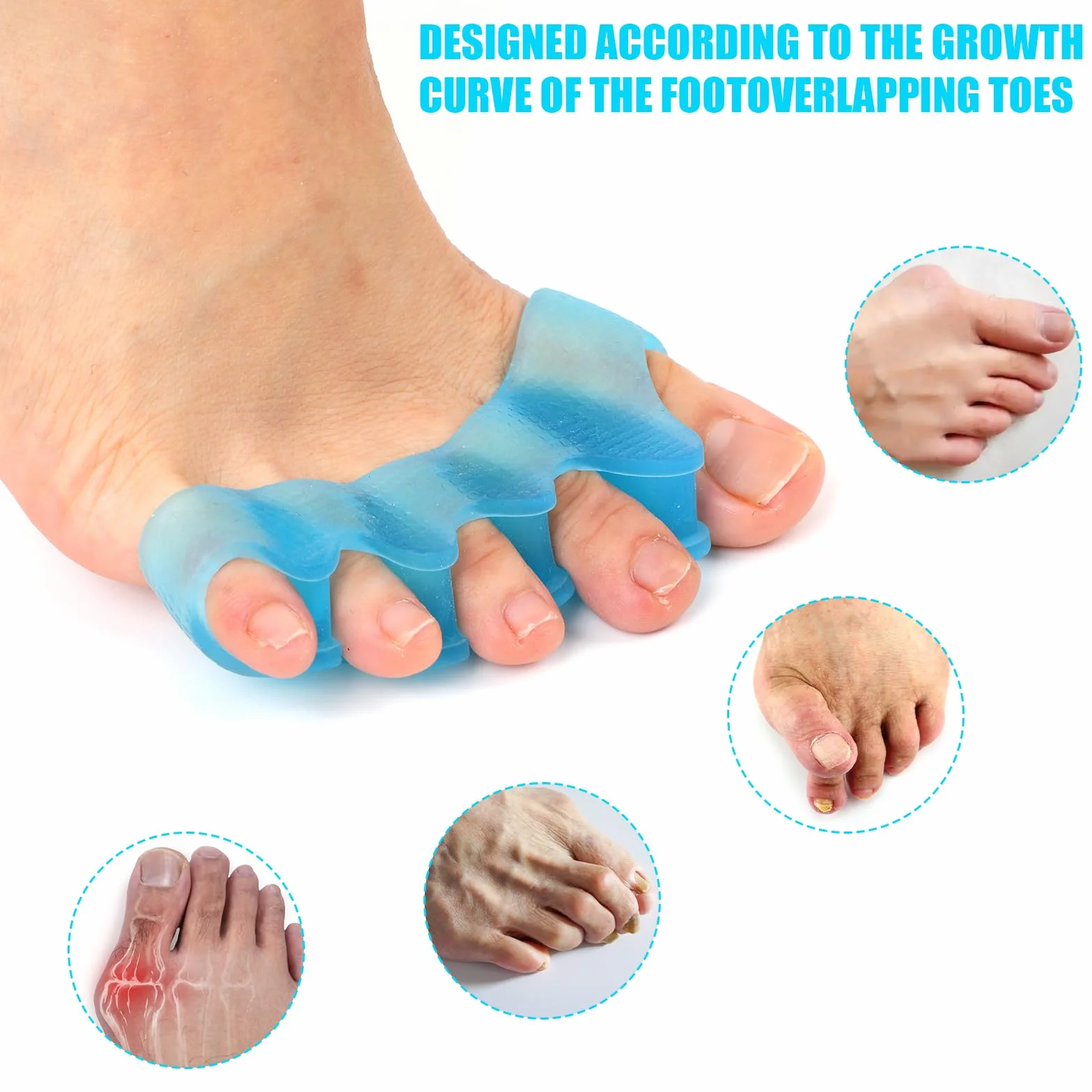 2szt Separatory Palców do Pedicure, Silikonowe Niebieskie Dystanse do Palców Miekkie Korektor Palców dla Kobiet Mezczyzn Nakladajace Sie Palce Lakier do Paznokci