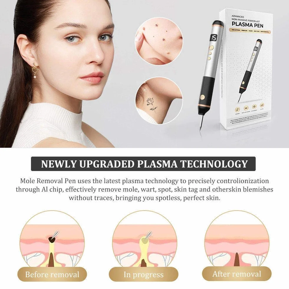 15-Poziomowy Laser Plazmowy Do Usuwania Narośli Skórnych, Brodawek, Pieprzyków, Plam, Piegów, Znamion, Ust, Dłoni, Oczu, Szyi, Twarzy, Głowy, Nosa, Bezpieczny I Bezbolesny, Nie Uszkadza Skóry