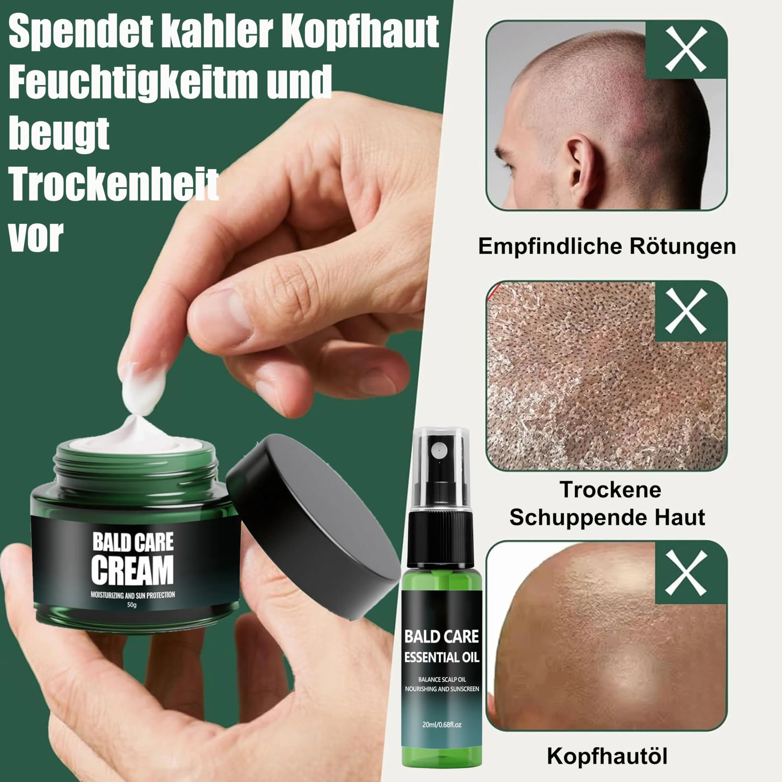 Pielęgnujący krem na łysinę i spray do pielęgnacji skóry głowy - zestaw, krem do pielęgnacji skóry głowy, pielęgnujący spray dla łysych, nawilżająca pielęgnacja łysej głowy, odświeżający i