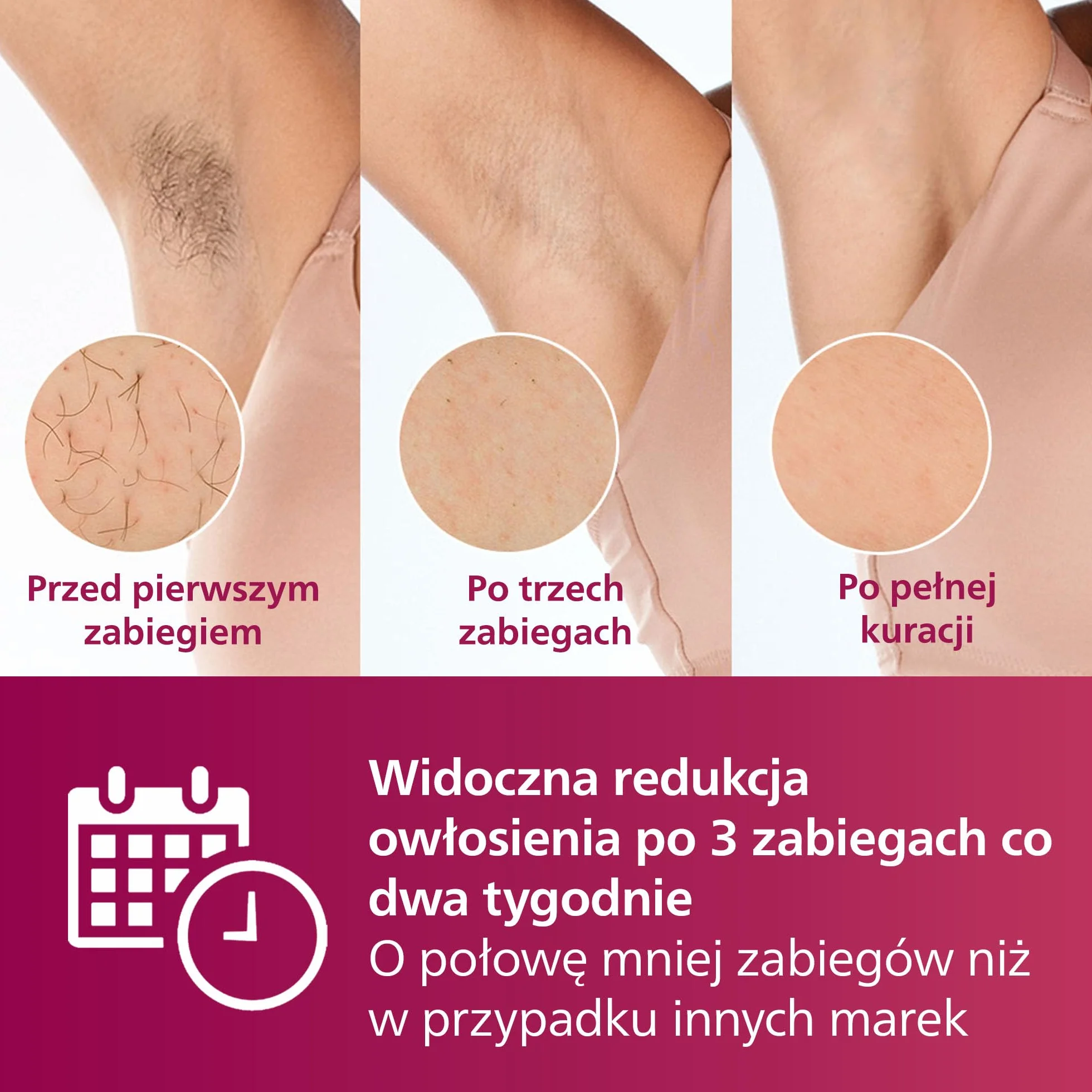 Philips Lumea Advanced urządzenie do usuwania włosów IPL z filtrem światła do twarzy (model SC1997/00)