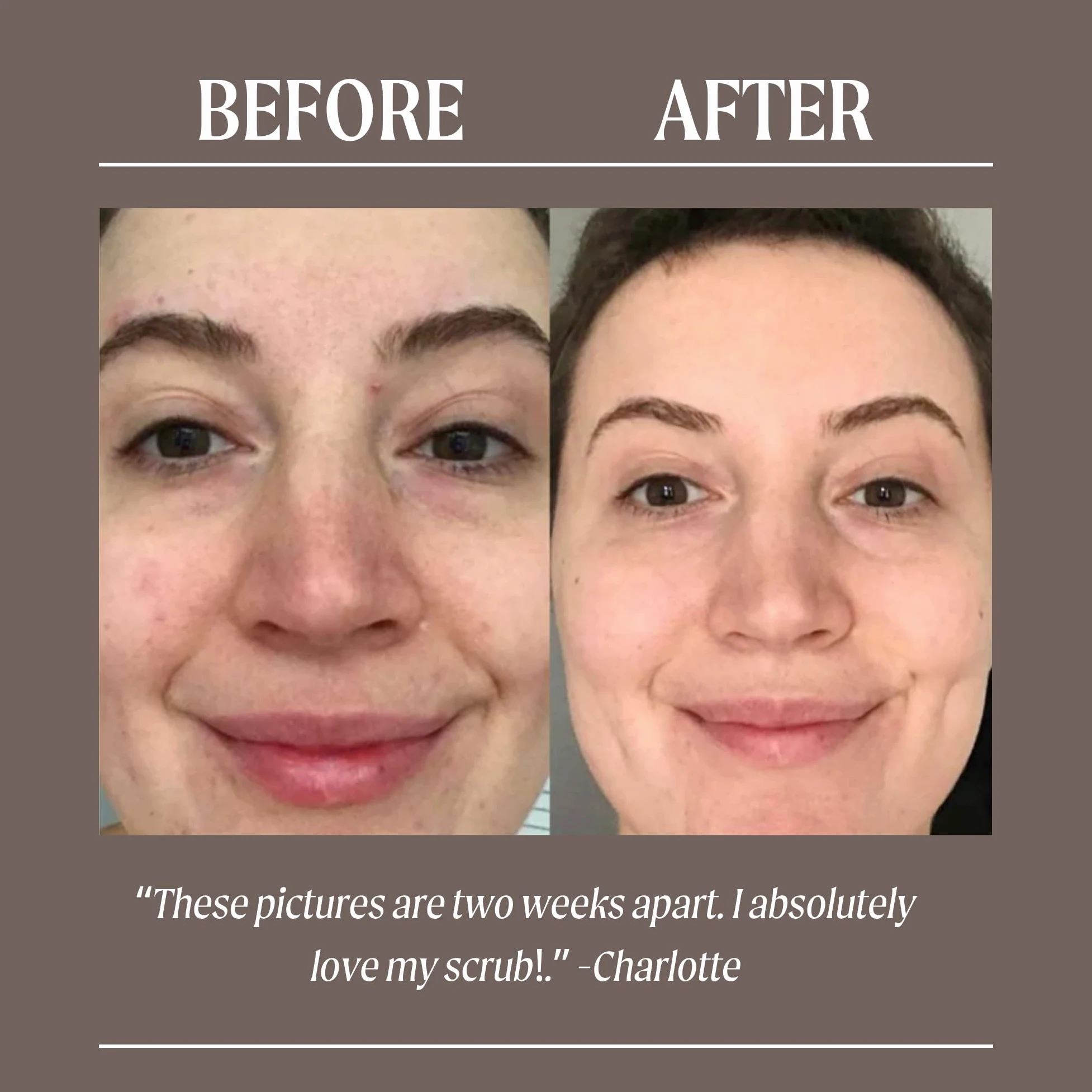 UpCircle Coffee Face Scrub - mieszanka cytrusów do skóry normalnej i suchej 100 ml - masło shea, olej kokosowy + olejek z dzikiej róży - naturalny, wegański peeling do twarzy dla miękkiej, gładkiej