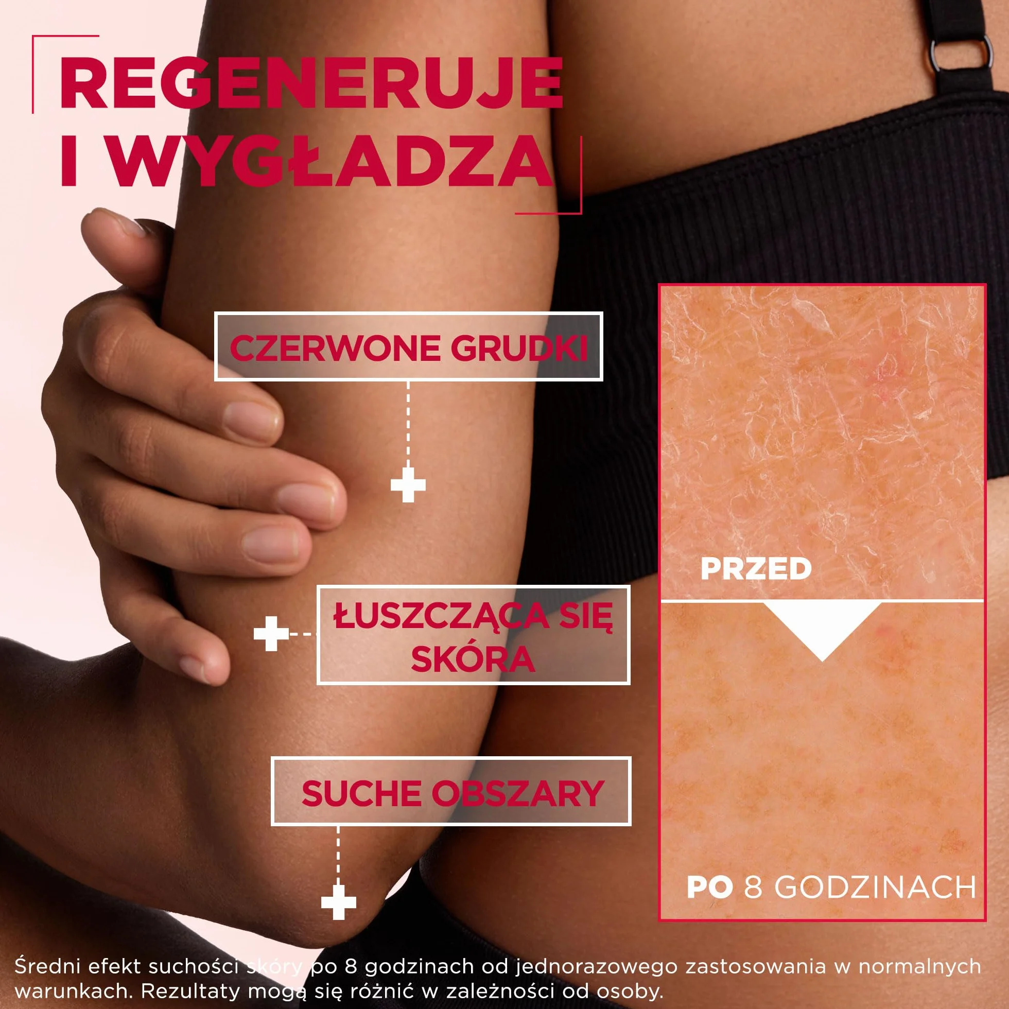 Mixa Urea Cica Repair+ Regenerujący Krem, 400 ml