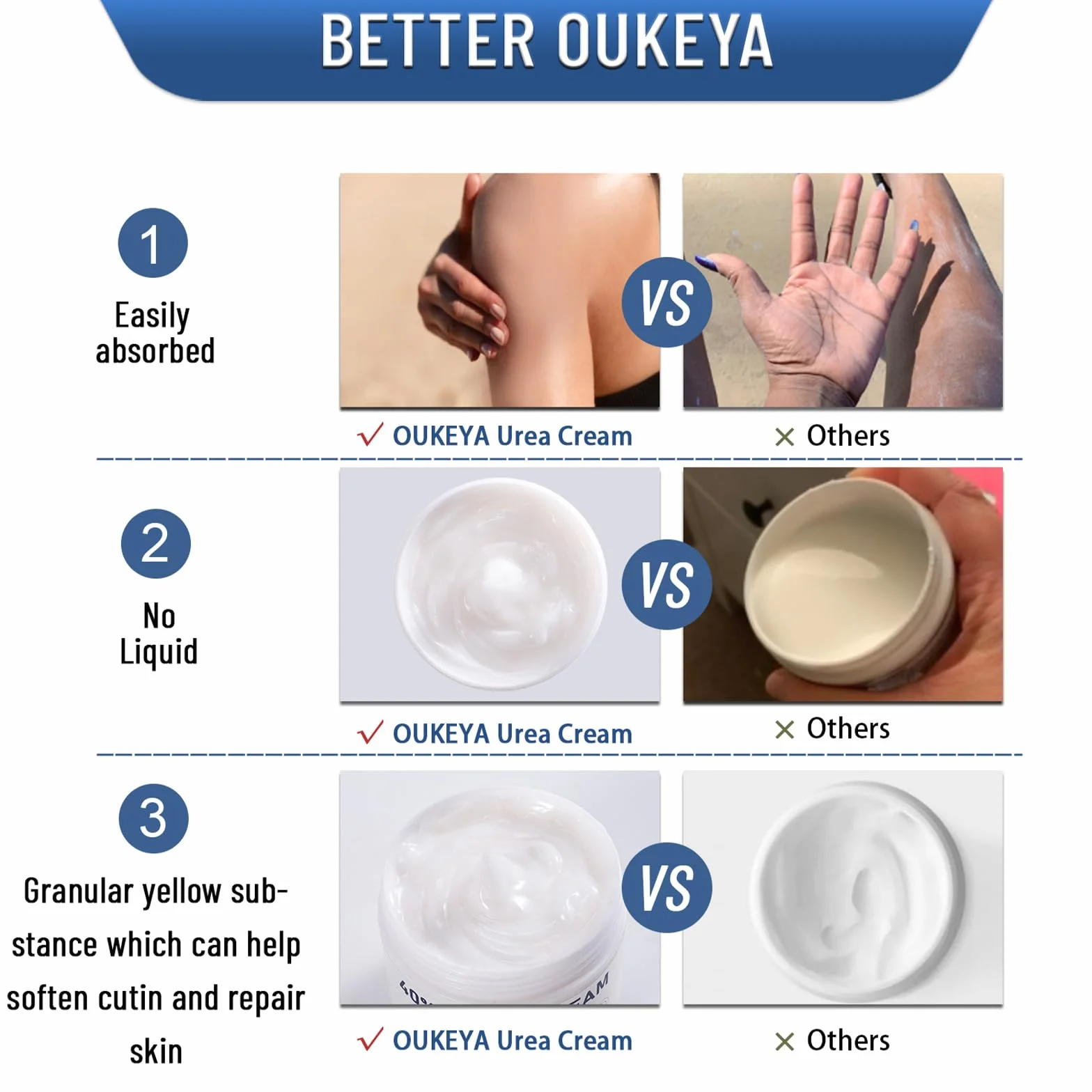 Krem Mocznikowy 40%, do Stóp i Rąk na Suche Pęknięcia, Lotion z 40% Moczniku, Maksymalna Siła, 150 g (1 Paczka)