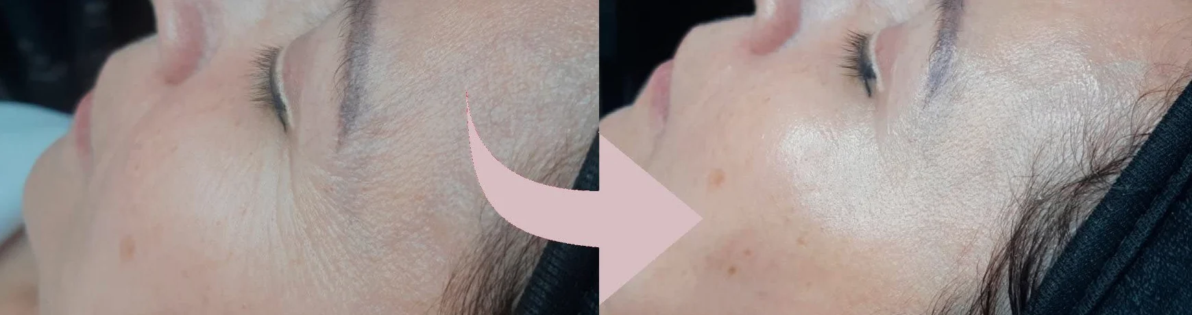 Casmara, krem do twarzy Infinity 50 ml - natychmiastowy efekt liftingu, odmładza dojrzałą skórę i zwalcza głębokie zmarszczki