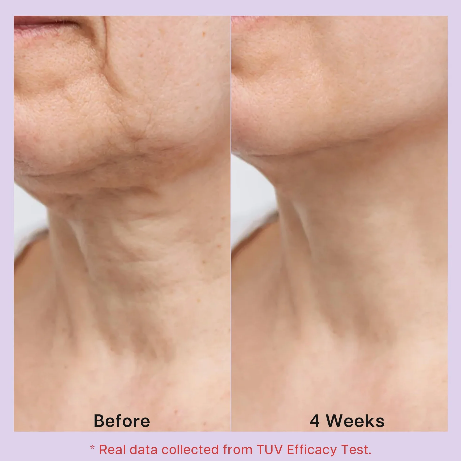 VRAIKO RoscMinc AH-8 Neck Cream, kwas hialuronowy i olejek jojoba, krem ujędrniający na szyję, nawilżający do wygładzania zmarszczek i odżywczy krem nawilżający do twarzy na szyi, klatce piersiowej