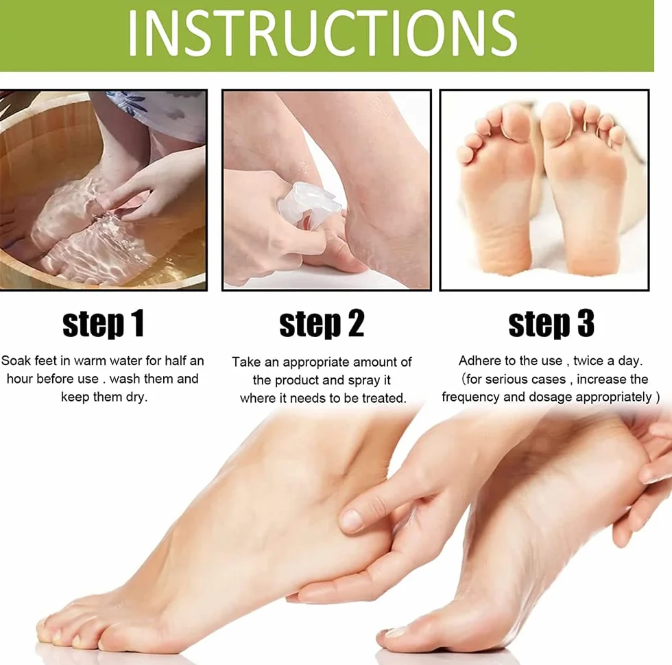 Foot Peel Spray,Foot Peeling Spray Orange Oil,Foot Peeling Spray That Remove Dead Skin,Hydrating Nourish Peel Off Spray,Quickly Remove Dead Skin and Calluses on Feet (Tangerine)
