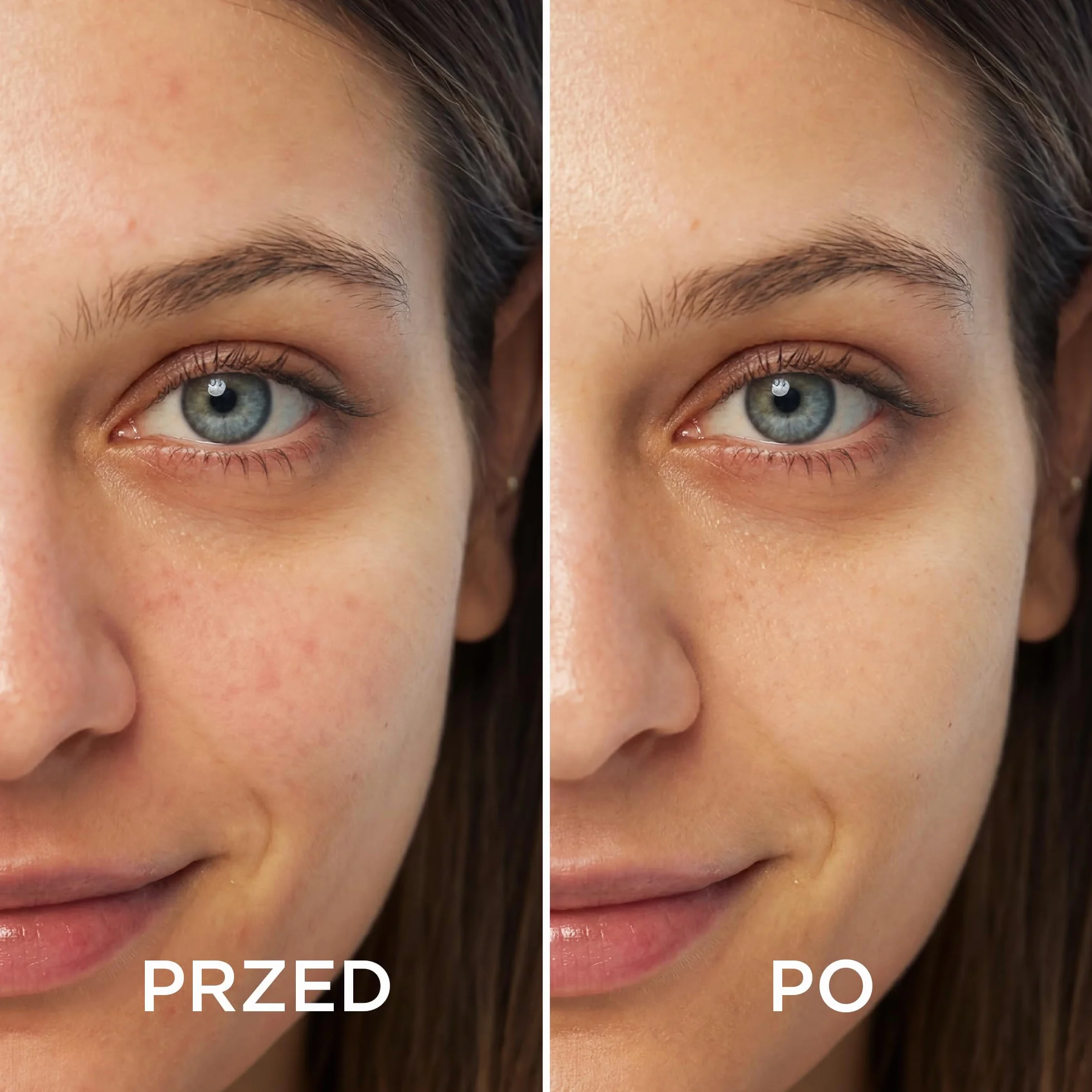 NÉO MAKE UP Baza pod makijaż wyrównująca koloryt skóry - Intense Serum COLOUR CORRECTING - Koryguje Niedoskonałości - Neutralizuje Zaczerwienienia - 30 ml
