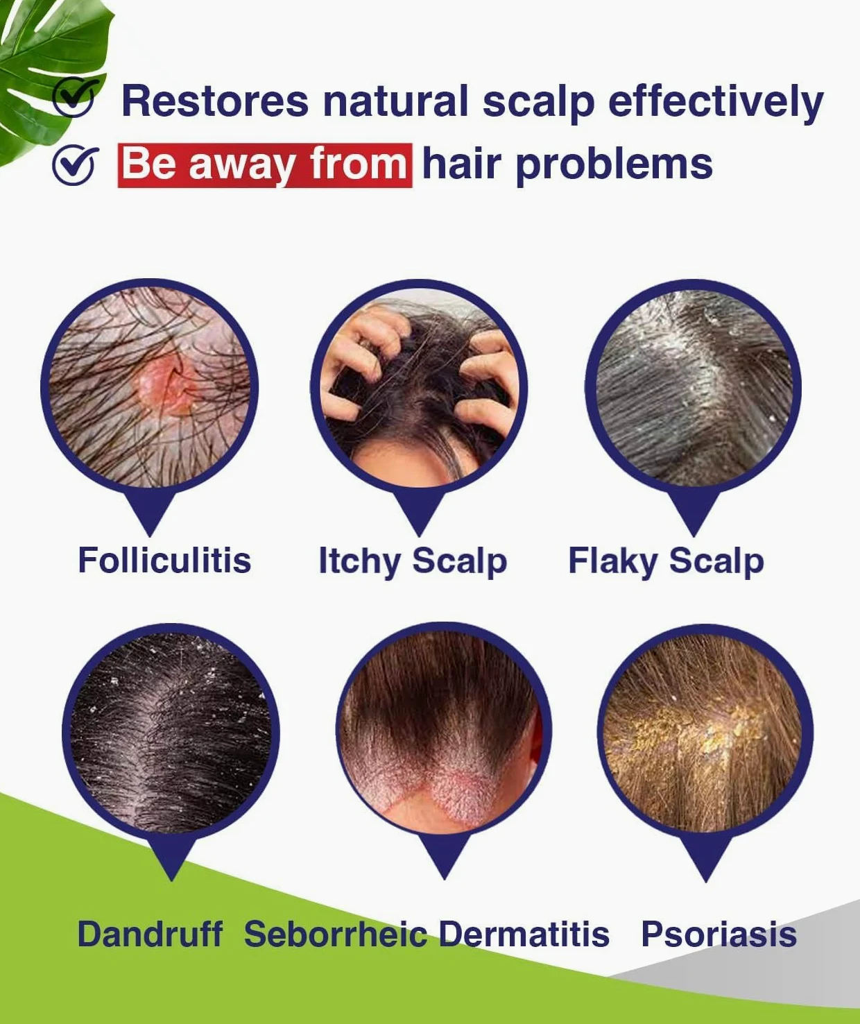 Szampon na zapalenie mieszków włosowych, Seborrheic Dermatitis Shampoo, szampon przeciw łupieżowi, szampon przeciwgrzybiczny, leczenie zapalenia mieszków włosowych, leczenie łupieżu, leczenie