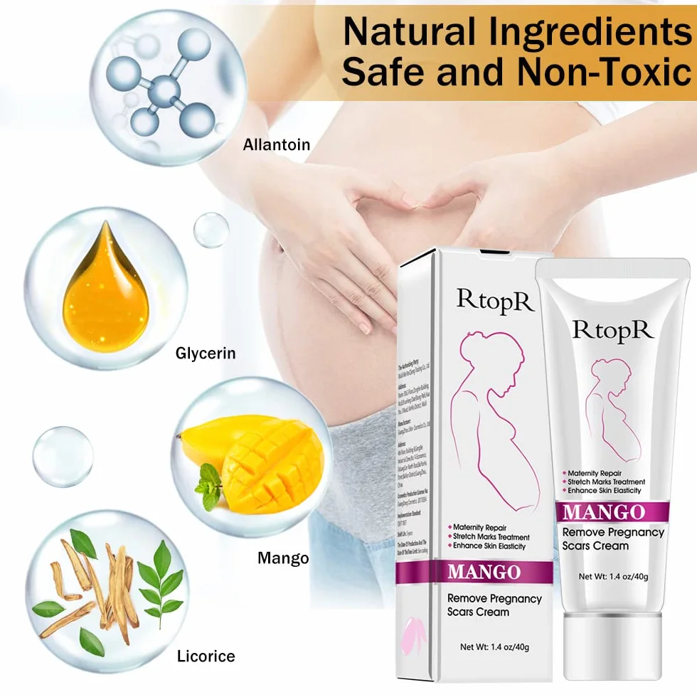Krem na rozstępy, krem do usuwania blizn, krem do naprawy rozstępów, blizn ciążowych, krem Stretch Marks Cream, 40 g