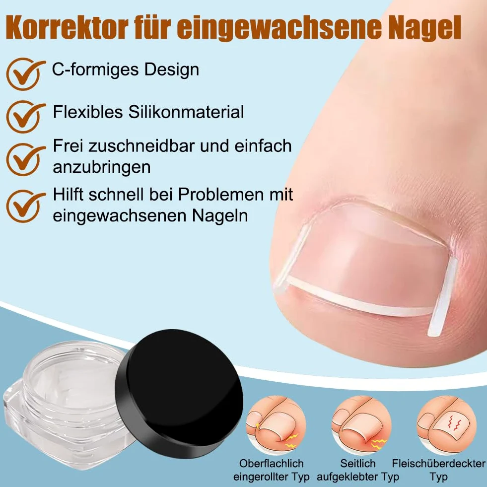 Zestaw do korekcji wrastających paznokci u stóp, 139 sztuk, z łatką do korekcji paznokci u stóp, wkładki do paznokci w kształcie litery C, zestaw narzędzi do pielęgnacji stóp – obcinacz do paznokci